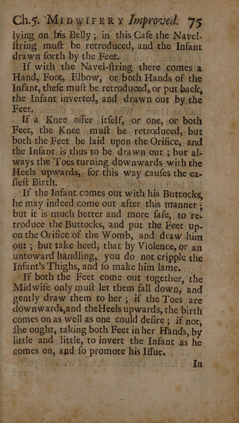 lying on bis Belly ;, in, this.Cafe the Navel- {tring muft be retroduced, and the Infant drawn forth by the Feet... 44.4) _ If with the Navel-ftring. there comes'a Hand, Foot, Elbow, or/both Hands of the Infant, thefe muft be retroduced, or put back, the Infant inverted, and drawn out by-the Beet oisisilh dor ebb CANE “U0! Loa . If a Knee,offer ,icfelf,or one, or both Feet, the. Knee muft. be. retroduced,- but both the Feet be laid upon-the Orifice, , and the Infant, is thus to be drawn ont.; but’ al- ways the ‘Toes turning downwards-with the Heels upwards,, for. this way caufes the ea- fielt Birth, ” Hirao ws foo ails Fobd Pal if the Infant.comes out with his Buttocks, he may indeed.come out after this manner : but it is much better andi more fafe, toree troduce the Buttocks, and put the Feet up- on the Orifice of the Womb, and draw him out ; but take heed, that by Violence, or an untoward handling, you do not cripple the Infant’s Thighs, and fo make him lame... _ If both the Feet come out together, the Midwife only muit let them fall down; and cently draw them to her ;. if the Toes are downwards,and theHeels upwards, the birth comes on as well as one could defire ; if nor, fhe ought, taking both Feet inher Hands, by little and little, to invert the Infant as he comes on, and fo promote his Iffue. _ ty In