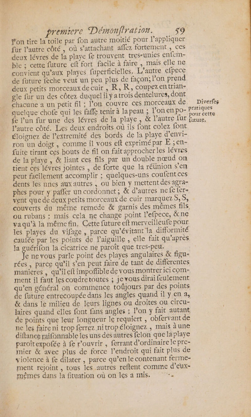 fon tire la toile par fon autre moitié pour appliquer far l’autre côté, où s’attachant aflez fortement , ces deux lévres de la playe fe trouvent tres-unies enfem- ble ; cette future eft fort facile à faire , mais elle ne convient qu'aux playes fuperficielles, L'autre efpece de fature feche veut un peu plus de façon; l’on prend deux petits morceaux de cuir , R,R, coupez entrian- gle fur un des côtez duquelilyatrois dentelures, dont chacune a un petit fil ; l’on couvre ces MOrCcEaux de. Diverfes quelque chofe qui les fafle tenir à la peau ; l’onenpo- Pratiques fe l’un fur une des lévres de la playe, &amp; l’autre fur on l’autre côté. Lies deux endroits où ils font colez font vs éloignez de l’extremité des bords de la playe d’envi- | ron un doigt, comme il vous eft exprimé par E ;en- à fuite tirant ces bouts de fil on fait approcher les lévres de la playe , &amp; liant ces fils par un double nœud on | | tient ces lévres jointes , de forte que la réünion s’en | à peut facilement accomplir : quelques-uns coufent ces dents les unes aux autres , ou bien y mettent des agra- phes pour y pañer un cordonnet ; &amp; d’autres ne fe fer- vent que de deux petits morceaux de cuir marquez S, 5, couverts du même remede &amp; garnis des mêmes fils, ou rubans : mais cela ne change point Pefpece, &amp;cne vaqu’à la mêmefin, Cette future eft merveilieufe pour | les playes du vifage, parce qu’évitant la difformité caufée par les points de l'aiguille , elle fait qu'après la guérifon la cicatrice ne paroît que tres-peu. | fe ne vous parle point des playes angulaires &amp; figu- rées , parce qu’il s’en peut faire de tant de differentes manieres , qu’il eft tmpoffble de vous montrer ici com- ment il faut les coudretoutes ; je vous dirai feulement qu’en général on commence totjours par des points de future entrecoupée dans les angles quand il ÿ en a, &amp; dans le milieu de leurs lignes ou droites ou circu- laires quand elles font fans angles : l’on y fait autant de points que leur longueur le requiert , obfervant de ne les faire ni trop ferrez nitropéloignez , mais àune diftance raifonnable les uns des autres felon que la playe paroïtexpofée à fe r’ouvrir , ferrant d'ordinaire le pre- mier &amp; avec plus de force l’endroit qui fait plus de violence à fe dilater , parce qu’en le contenant ferme- ment rejoint , tous les autres reftent comme d’eux- mêmes dans la fituation où on les a mis. . à ©