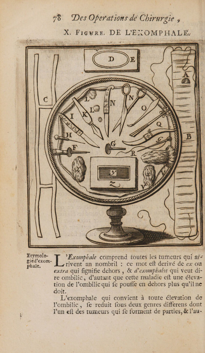 X. FiGwre. DE L'EXOMPHALE 1 RRMIEUE TS eo Ga à + en ee comprend toutes les tumeurs qui af* phale, rivent an nombril : ce mot eft derivé de ex ou extra qui fignifie dehors , &amp; d’exomphalrs qui veut di- re ombilic, d’autant que cette maladie eft une éleva- tion de l’ombilic qui fe poufle en dehors plus qu’ilne doit. L’exomphale qui convient à toute élevation de Pombilic, fe reduit fous deux genres differens dont lun eft des tumeurs qui fe forment de parties, &amp; l’au-