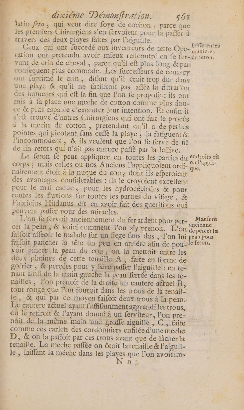 latin féra, qui veut dire foye de cochon &gt; Parce que les premiers Chirurgiens s’en fervoient pour la pañèr à travers des deux playes faites par l'aiguille. Ceux qui ont fuccedé aux inventeurs de cette Ope- ration ont.pretendu avoir mieux rencontré en fe {èr- contequent plus commode. Les fuccefleurs de ceux-cy manieres du feton: une playe &amp; qu’il ne facilitoit pas aflez la filtration des humeurs qui eft la fin que l’on fe propofe : ils ont mis à fa place une meche de cotton comme plus dou- ce &amp; plus capable d'executer leur intention. Et enfin il s’eit trouvé d’autres Chirurgiens qui ont fait le procès pointes qui picotant fans cefle la playe ; la fatiguent &amp; l'incommodent , &amp; ils veulent que l’on fe ferve de fil de lin retors qui n’ait pas encore pañlé par la leflive. Le feron fe peut appliquer en toutes les parties du corps; mais celles ou nos Anciens l’appliquoient ordi- nairement étoit à la nuque du cou; dont ils efperoïent des avantages confiderables : ils le croyoient excellent pour le mal caduc, pour les hydrocéphales &amp; pour toutes les fluxions fur toutes les parties du vifage, &amp; Fabricius, Hildanus. dit en.ayoir fait des guerifons qui peuvent pañler pour des miracles. | | L'on f&amp;fervoit anciennement du fer ardent pour per- cer la peau ; &amp; voici comment l’on s’y prenoit. L'on endroits où que. Manieté ancienne de percer læ&amp; voir pincer .la peau du cou, on la mettoit entre les goïrier ; &amp; percées pour y fairépañler l'aiguille : en te- nant ainfi de la main gauche la peau ferrée dans les te- nailles , l’on prenoït de 1a droite un cautere aétuel B, Le cautere aétuel ayant fufifammentagprandi les trous, On le retiroit &amp; l’ayant donné’à un ferviteur, l’on pre- noit de, la.même main une groffe aiguille , C., füite comme ces carlets des cordonniers enfilée d’une meche D, &amp; on la pañloit par ces trous avant que de lâcher la tenaille. La meche paflée on Ôtoit latenaille &amp; Paiguil&lt; le , laïffant la méche dans les playes que l’on avoitimx RL '#