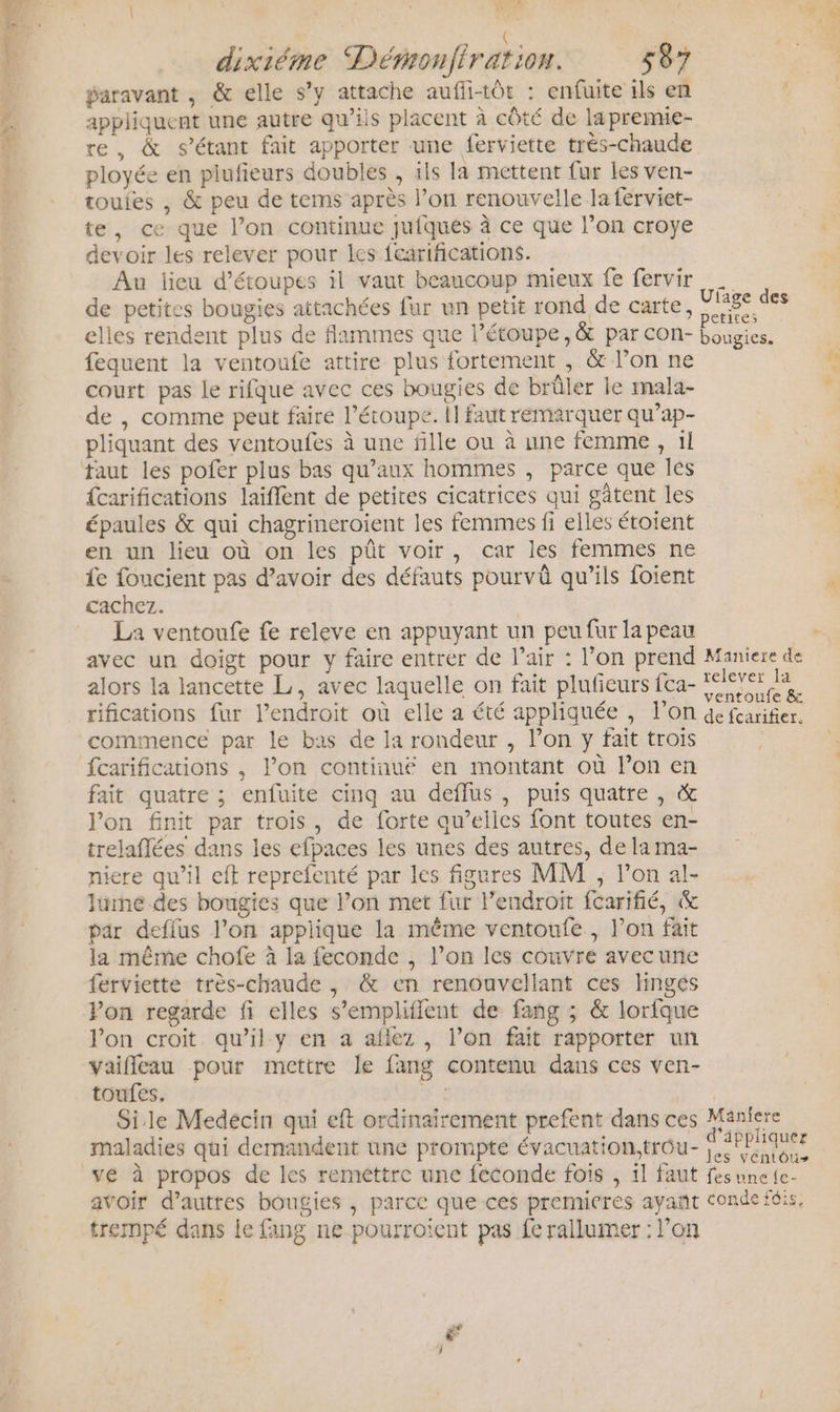 dixiéme Déronfiration. 587 ÿaravant , &amp; elle s’y attache aufli-tôt : enfuite ils en appliquent une autre qu’ils placent à côté de lapremie- re, &amp; s'étant fait apporter une ferviette très-chaude ployée en plufeurs doubles , ils la mettent fur les ven- touies , &amp; peu de tems après l’on renouvelle la ferviet- te, ce que l’on continue jufqués à ce que lon croye 2 devoir les relever pour les fearifications. | Au lieu d’étoupes il vaut beaucoup mieux fe fervir de petites bougies attachées fur un petit rond de carte, M elles rendent plus de flammes que l’étoupe , &amp; par cOn- bougies. fequent la ventoufe attire plus fortement , &amp; l’on ne di court pas Le rifque avec ces bougies de brüler le mala- 1 de , comme peut faire l’étoupe. 11 faut remarquer qu’ap- | pliquant des ventoufes à une fille ou à une femme, il taut les pofer plus bas qu'aux hommes , parce que les ‘je {carifications laiffent de petites cicatrices qui gâtent les #4 épaules &amp; qui chagrineroient les femmes fi elles étoient en un lieu où on les pût voir, car les femmes ne fe foucient pas d’avoir des défauts pourvû qu’ils foient cachez. La ventoufe fe releve en appuyant un peu fur la peau avec un doigt pour y faire entrer de l'air : l’on prend Maniere de alors la lancette L, avec laquelle on fait plufieurs fca- nai Fe rifications fur l’endroit où elle a été appliquée , l’on de fcarifier. commence par le bas de la rondeur , l’on y fait trois fait quatre ; enfuite cinq au deffus, puis quatre , &amp; l'on finit par trois, de forte qu’elles font toutes en- trelaflées dans les efpaces les unes des autres, de la ma- nicre qu’il eff reprefenté par les figures MM , l’on al- lune des bougies que l’on met fur l'endroit fcarifié, &amp; par defilus l’on appiique la même ventoufe , l’on fait la même chofe à la feconde , l’on les couvre avecune ferviette très-chaude , &amp; en renouvellant ces linges Pon regarde fi elles s’empliflent de fang ; &amp; lorfque Jon croit qu’il y en a aflez , l’on fait rapporter un vaifleau pour mettre le fang contenu dans ces ven- toufes. fs Sile Medecin qui eft ordinairement prefent dans ces Maniere maladies qui demandent une prompte évacuation.trou- ne ds vé à propos de les remettre une feconde fois , 1l faut fesune{e- avoir d’autres bougies , parce que ces premieres ayañt conde fois, trempé dans le fang ne pourroient pas fe rallumer : l’on