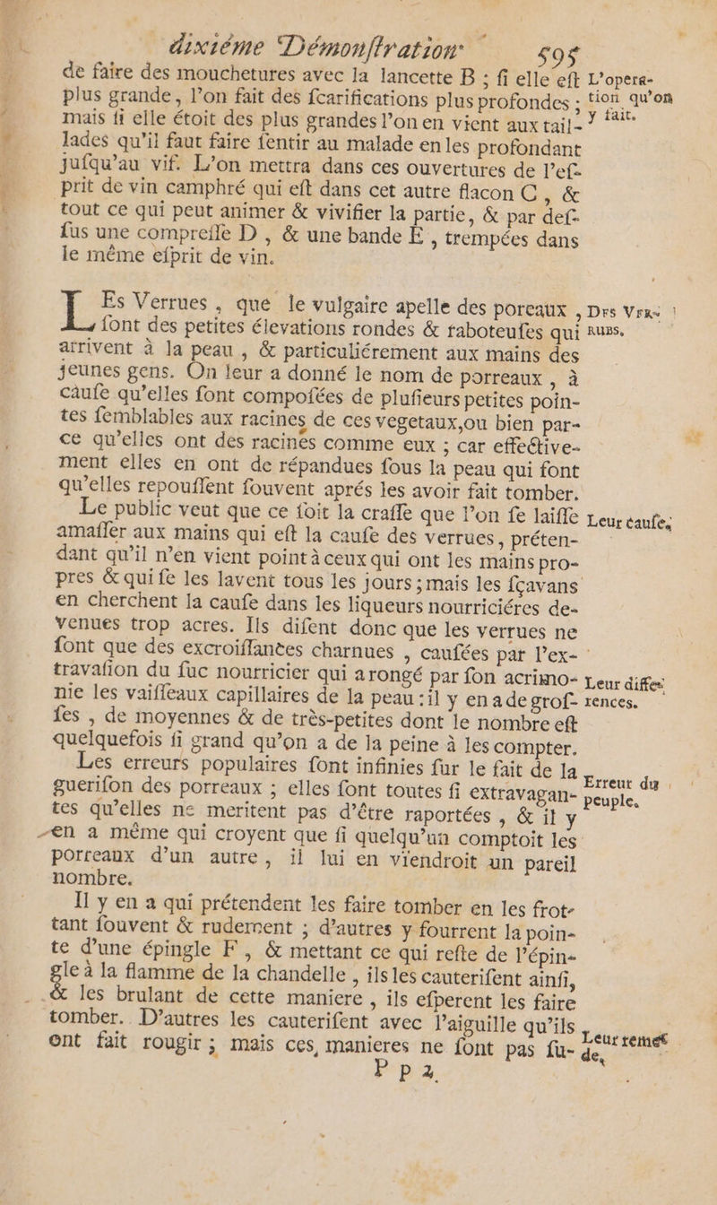 / mais fi elle étoit des plus grandes l’on en vient aux tail - # lades qu’il faut faire fentir au malade enles profondant g jufqu’au vif. L’on mettra dans ces ouvertures de l’ef- Ê prit de vin camphré qui eft dans cet autre flacon C A à k tout ce qui peut animer &amp; vivifier la partie, &amp; par def. {us une comprefle D , &amp; une bande Ë, trempées dans le même efprit de vin. arrivent à la peau , &amp; particuliérement aux mains des jeunes gens. On leur a donné le nom de porreaux , à caufe qu’elles font compofées de plufeurs petites poin- tes femblables aux racines de ces vegetaux,ou bien par- ce qu'elles ont des racines comme eux ; car effective ment elles en ont de répandues fous la peau qui font qu'elles repouflent fouvent aprés les avoir fait tomber. ag amañler aux mains qui eft la caufe des verrues , préten- dant qu’il n’en vient point à ceux qui ont les mains pro- pres &amp; qui fe les lavent tous les jours ; mais les fçavans en cherchent Ia caufe dans les liqueurs nourriciéres de- venues trop acres. Îls difent donc que les verrues ne font que des excroiffantes charnues » Caufées par l’ex- : travafñon du fuc nourricier qui arongé par fon acrimo- L eur diffes fes |, de moyennes &amp; de très-petites dont le nombre eft quelquefois fi grand qu’on a de Ja peine à les compter. es erreurs populaires font infinies fur le fait de la guerifon des porreaux ; elles font toutes fi extravagan- tes qu’elles n£ meritent pas d’être raportées , &amp; il y -€n a même qui croyent que fi quelqu'un comptoit les porreaux d’un autre, ïl Jui en viendroit un pareil nombre. I y en a qui prétendent les faire tomber en les frot- tant fouvent &amp; ruderrent ; d’autres y fourrent la poin- te d’une épingle F, &amp; mettant ce qui refte de l’épin- le à la flamme de la chandelle , ilsles cauterifent ainfi, ; &amp; les brulant de cette maniere , ils efperent les faire tomber. D’autres les cauterifent avec l'aiguille qu’ils ont fait rougir ; mais ces manieres ne font pas fu- q Ppz +