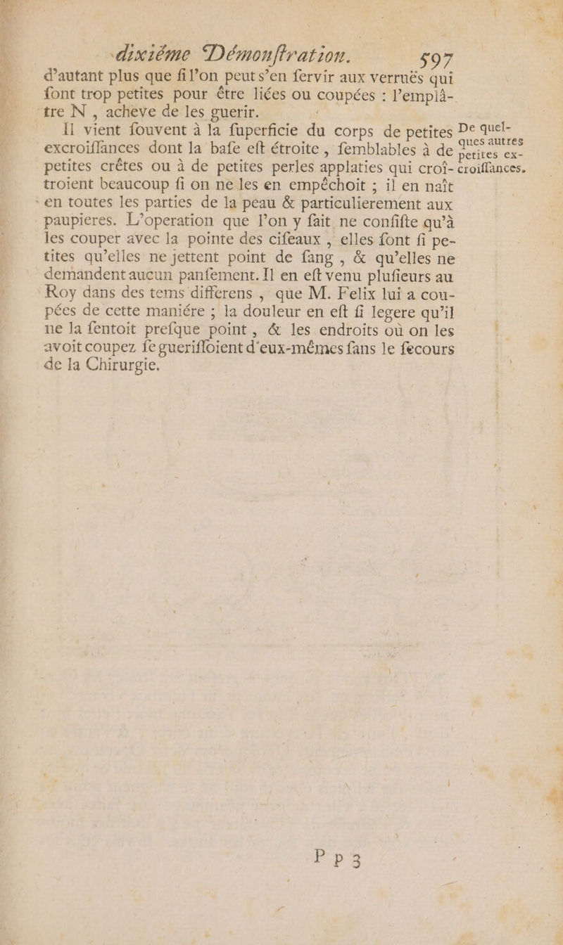 d'autant plus que fi l’on peuts’en fervir aux verruës qui font trop petites pour être liées ou coupées : l’emplà- ‘tre N°, acheve de les guerir. | I vient fouvent à la fuperficie du corps de petites D® aa excroiflances dont la bafe eft étroite , femblables à de titel exc petites crêtes ou à de petites perles applaties qui crof- croiffances. troient beaucoup fi on ne les en empéchoit ; il en naît ‘en toutes les parties de la peau &amp; particulierement aux paupieres. L’operation que l’on y fait ne confifte qu’à les couper avec la pointe des cifeaux , elles font fi pe- tites qu’elles ne jettent point de fang , &amp; qu’elles ne demandent aucun panfement. Il en eft venu plufieurs au Roy dans des tems différens , que M. Felix lui a cou- pées de cette maniére ; la douleur en eft fi legere qu’il ne la fentoit prefque point, &amp; les endroits où on les À avoit coupez Îe guerifloient d'eux-mêmes fans le fecours de la Chirurgie, L. E* é+r 4