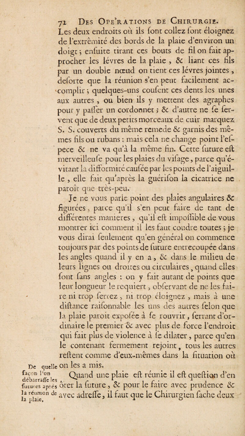 Les deux endroits où iis font collez font éloignez de l'extrémité des bords de la plaie d’environ un doigt -, enfuite tirant ces bouts de fil on fait ap¬ procher les lèvres de la plaie , 8c liant ces fils par un double nœud on tient ces lèvres jointes, deforte que la réunion s’en peut facilement ac¬ complir ; quelques-uns coufent ces dents les unes aux autres , ou bien ils y mettent des agraphes pour y palier un cordonnet ; 8c d’autre ne fe fer¬ vent que de deux petits morceaux de cuir marquez. S. S. couverts du même remede 8c garnis des mê¬ mes fils ou rubans : mais cela ne change point l’efc pece 8c ne va qu’à la même fin. Cette future eft merveilleufe pour les plaies du vifage, parce qu’é¬ vitant la difformité caufée par les points de l’aiguil¬ le , elle fait qtfaprès la guérifon la cicatrice ne paroît que- très-peu. Je ne vous, parle point des plaies angulaires 8c figurées 5 parce qu’il s’en peur faire de tant de différentes maniérés, qu’il eft impoifible de vous montrer ici comment il les faut coudre toutes ; je vous dirai feulement qu’en général on commence toujours par des points de future entrecoupée dans les angles quand il y en a, 8c dans le milieu de leurs lignes ou droites ou circulaires 5 quand elles font fans angles : on y fait autant de points que leur longueur le requiert 5 obfervant de ne les fai¬ re ni trop ferrez 5 ni trop éloignez , mais à une diftance raifonnable les uns des autres félon que la plaie paroit expofée à fe rouvrir , ferrant d’or¬ dinaire le premier 8c avec plus de force l’endroit qui fait plus de violence à fe dilater, parce qu’en le contenant fermement rejoint f tous les autres reftent comme d’eux-mêmes dans la fituation ou De quelle OU les a mis. déWraff!es Q.uan^ une ptaie eft réunie il eft queftion d’en futures après orer la future, 8c pour le faire avec prudence 8c la réunion de avec aftrefpe3 il faut que le Chirurgien fâche deux