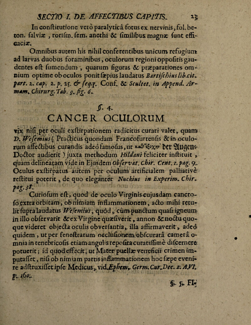 In conftitutione vero paralytica fotus ex nervinis,fol. be- ton. falvix , rorifm. fem. anechi &c fimilibus magnae funt efii- cacix. - Omnibus autem his nihil conferentibus unicum refugium ad larvas duobus foraminibus, oculorum regioni oppofitis gau¬ dentes eft fumendum , quarum figuras & prxparationes om¬ nium optime ob oculos ponit farpius laudatus Bartifchiuslihxit*. fart. z. cap, z.p. 25. & fecjq. Conf & Scultet. in Append. Ar~ m*m% Chirurg 7ab. q, fig 6.. CANCER Jf. 4* OCULORUM rix ni(I.per oculi exffirpationem radicitus curari valet, quam D* Wefe ritius ( Pradicus quondam Francofurtenfis & in oculo¬ rum affedibus curandis adeofamofus,ut ttt StUQCtt*' Dodor audierit ) juxta methodum Hi Idan i feliciter inftituit , quam delmeatam vide in Ejusdem Ob fervat, chir. Cent. r. pag. 9.. Oculus exftirpatus autem per oculum artificialem paliiativc' reffitui poterit, de quo eleganter Nuckius in Experim. Chir* pag3*~ 1 ; Curiofum elKquod de oculo Virginiscujusdam cancro- fo extra orbitam , ob nimiam inflammationem, ado mihi retu¬ lit fupra laudatus We[enrtus> quodcun* pundum qua fi'igneum in illo obfervarit ScexVirgine quxfiverir *annon sinodu quo¬ que videret objeda oculis obveriantia,, illa affirmaverit, adeo quidem , ut per feneftrarum occlufionem obfcurara camera o- mnia in tenebricofis etiam angulis repofira curatiflime difeernere potuerit; id quodeffecit, ut Mater puellsr veneficii' crimen im¬ puta fle t, nifiob nimiam partis inflammationem hoc fxpe eveni*