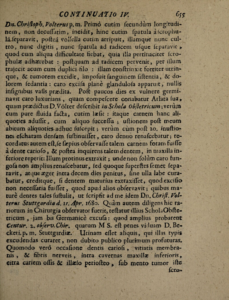 Dn.Chri/lopb.Folterusp.tn. Primo cutim fecundum longitudi¬ nem, non decuflatim, incidit, hinc cutim fpatula afcrophu- kLfeparavit, poftea volfella cucim arripuit, illamque nunc cul¬ tro, nunc digitis , nunc fpatula ad radicem ufque fcparavic » quod cum aliqua difficultate fiebat, quia illa pertinaciter fcro- phulac adhaerebat : poftquam ad radicem pervenit, per ilium trajecit acum cum duplici filo : illam conftrinxic fortiter utrin- que, & tumorem excidit, impofuit fanguinem fidentia, &: do¬ lorem fedantia : caro cxcifa plane glandulofa apparuit, nullis infigrubus vafis prardita. Poft paucos dies ex vulnere germi¬ navit caro luxurians , quam compefcere conabatur Arlata fua* quatnpra:di<5tusD.V6!ter deferibit in Schola Ob/letricum^vcxvi&k cum pure fluida fa&a, cutim larfit : itaque carnem hanc ali¬ quoties aduflit, cum aliqua fucceflu ; uftionem poft meum abitum aliquoties adhuc fufeepit v verum cum poft zo. inuftio- nes efcharam denfam fuftinuiflet, caro denuo renafeebatur; re¬ cordatus autem eft,fefipiusobfervafle talem carnem fotam fui fle a dente cariofo, & poftea inquirens talem dentem, in maxilla in¬ feriore reperit: Illum protinus extraxit; undenon folilmcaro fon- gofa non amplius renafeebatur, fed quoque fuperftesfemec fepa- ravit, atque a:ger intra decem dies penitus, fine ulla labe cura¬ batur, creditque, fidentem maturius extraxiflet, quodexcifio non neceflaria fui flet, quod apud alios obfervavit; quibus ma¬ ture dentes tales fuftulit, ut fcripfit ad mc idem DnXhrijt. Vol- tcrus Stuttgardia d. ir.Apr. 1680. Quam autem diligens hic ra¬ riorum in Chirurgia obfervator fuerit, teftatur illius SchoIaObftc- tricum , jam bis Germanice excufa: quod amplius probarent Centur. z. obfcrv.Chir* quarum M S* eft penes viduam D. Bc- ckeri.p. m. Stuttgardia:/ Urinam eflet aliquis, qui illas typis excudendas curarer, non dubito publico plurimum profuturas* Quomodo vero occafione dentis cariofi , vitiatis membra¬ nis , & fibris nerveis, intra cavernas maxilla: inferioris, citra cariem offis & illacfo periofteo * fub mento tumor ifte Iero-» <