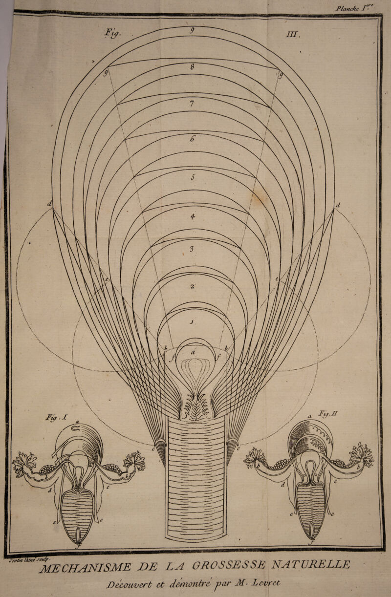 Planche 1*• v/-e MECHANISAIE DE LA GROSSESSE NATURELLE Découvert et démontre var A- Leur et