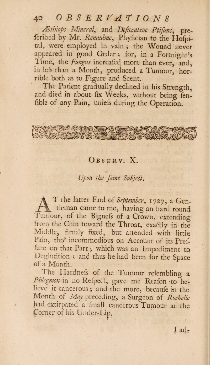 Mthiop Mineral, and Deftccative Ptifans, pre¬ ferred by Mr. Renaulme, Phyfician to the Hofpi- tal, were employed in vain ; the Wound never appeared in good Order ; for, in a Fortnight’s Time, the Fungus increafed more than ever, and, in lefs than a Month, produced a Tumour, hor¬ rible both as to Figure and Scent. The Patient gradually declined in his Strength, and died in about fix Weeks, without being fen- fible of any Pain, unlefs during the Operation. Observ. X. Upon the fame Subjeft. A T the latter End of Septejnber, 1727, a Gen- f~\ tleman came to me, having an hard round Tumour, of the Bignefs of a Crown, extending from the Chin toward the Throat, exactly in the Middle,, firmly fixed, but attended with little Pain, tho’ incommodious on Account of its Pref- fure on that Part; which was an Impediment to Deglutition ; and thus he had been for the Space of a Month. The Mardnefs of the Tumour refembling a Phlegmon in no Refpeft, gave me Reafon *to be¬ lieve it cancerous; and the more, becaufe m the Month of May preceding, a Surgeon of Rochelle had extirpated a fmall cancerous Tumour at the Corner of his IJnder-Lip. 4 * Jadr