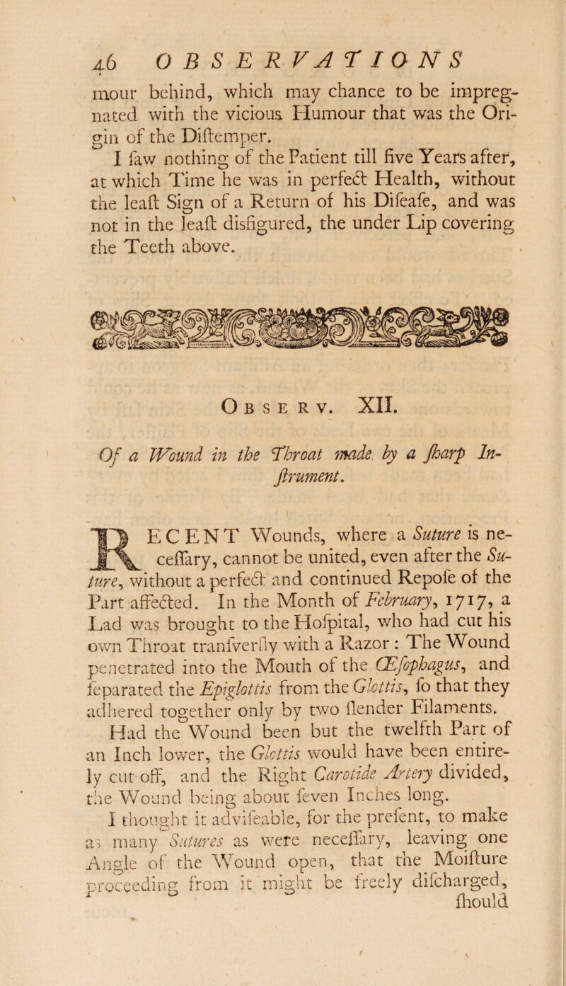 4 mour behind, which may chance to be impreg¬ nated with the vicious. Humour that was the Ori¬ gin of the Diftemper. I faw nothing of the Patient till five Years after, at which Time he was in perfed Health, without the lead Sign of a Return of his Difeafe, and was not in the leaf! disfigured, the under Lip covering the Teeth above. O B S E R V. XII. Of a Wound in the Throat made hy a Jharp In- ftrument. EC ENT Wounds, where a Suture is ne- __ ^ ceffary, cannot be united, even after the Su¬ ture, without a per fed and continued Repofe of the Part affeded. In the Month of February, 1717, a Lad was brought to the Hofpital, who had cut his own Throat tranfverfly with a Razor : The Wound penetrated into the Mouth of the CEfophagus, and feparated the Epiglottis from the Glottis, fo that they adhered together only by two (lender Filaments. Had the Wound been but the twelfth Part of an Inch lower, the Glottis would have been entire¬ ly cut-off, and the Right Carotide Artery divided, the Wound being about feven Inches long. I thought it advifeable, for the prefent, to make as many Sutures as were neceflary, leaving one Angle of the Wound open, that the Moifture proceeding from it might be freely difeharged, * 0 fhouia