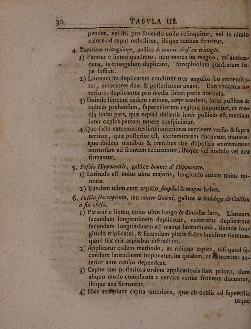 Losssnnncsnd | pendet, ud (3 pro E VEUdE collo FIERA vel: in nimio. calore .ad caput reflectitur, ibique. acubus firmatur. . — 4. fapitium triangülare , .gallice Je cowvre chef ei en triangle. dicidius I) Paratur e linteo quadrato, non tamen ita magno , uti antece- *,: 7. dens, intriangulum duplicato, Strophiolum quadratum fi. pe fuffickc. 8n A 2) Linteum ita duplicatum conftituit tres angulos fed extremita« tes, anteriores duas &amp; pofteriorem unam, É Extremitatesa  teriores duplicantur pro media lintei parte notanda, 5) Deinde linteum eadem ratione, aciprzcedens, inter ; pollices &amp;. indices prehenfum, fuperciliorum regioni i imponitur, ut me« dia lintei pars, que equali diflantia inter pollices. eft, mediam inter oculos partem. tenere confpiciatur, ^. ed | 4;Quo fado extremitátes lintei anteriores cervicem vetfüs &amp; phat tertiam, qua pofterior eft, extremitatem ducuntur, mutatis-. que ibidem manibus &amp; omnibus rite. difpofiti Itis extremitates. 'antrorfüm ad frontem: ij gs ibiqde v ve Bodulo vel acu firmantur, io: - istY il - E Faftia Hippocratis , zdlice dido: d Hibuitaln. UM d | I) Latitudo eft unius ulng majoris, longitudo autem unius mi- noris. 2) Eundem ufum. cum capitio f Ji plici &amp; magno. pae EJ Fafcia fex capitum, feu cancer Galeni, gallice He. Daidage de Gallien a fix chefs. Cor 0 i Hi nr VAEBZN : I) Paratur e linteo, unius ulnz longo &amp; dimidie lato, Cp fecundum longitudinem duplicatur, reiteratur duplicatura fecundum longitudiríem ad manus latitudinem , deinde lon« gitudo triplicatur, &amp; fecundum: plicas. factas inciditur linteum, quod fex erit capitibus inftru&amp;um.; ! | 2) Applicatüur eadem metliodo, ac reliqua. piel, nit 1 quod fe- cundum latitudinem imponatur, ita quidem, ut EXtremitas an- terior ante oculos dependeat. ^i Ff 3) Capita duo pofterióra ordine applicationis fifíót priora, oodd aliquo modo eoupHcda. à cervice VETE frontem ducuntur, - jbique acü firmantur, 2 a | 4) Hac dino iras anteriora, que n oculis ad | füpefcilia usque