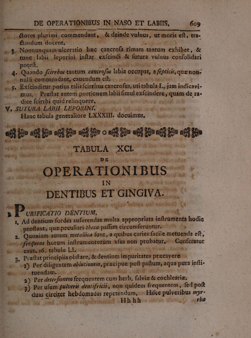 errorae -— ————M— . &amp;ores plurimi. commendant, &amp; deinde vulnus, ut moris eft, tra- &amp;aodum docent, - * Nonnunquam ulceratio hac PANIS rimam p exidbor , o ^s tune labii | leporini inBas. exífcindi &amp; fura vulnus. confolidari poteft, | 4- Quando firrbss tantum cancrofus labia occupat, 3 r ptis quz not- ,- nulli; comniendant, cauendum eft. ^. $. Exfcinditur potius talis fcirrhus cancrofus, uti sabls L. jam indicavi- gmus,. Preftat autem portionem labii fimul tilii quam de ra- .—.. dice fcirrhi quidrelinquere, |... | : V. SUTURA. LABiI LEPQRINIL. .5..4 Hanc tabula generaliore LXXX. docuimus, | e db dt dir dtr didit CAES ACL -OPERATIONIBUS- IN DENTIBUS ET GINGIVA- ) Any Q' 7N Tei xk URIFICATIO DENTIUM.- i 1, Ad dentium fordes auferendas- multa. appropriata in(trumenta hodie proftant; quz peculiari 2beza paffira circumferuntur. 2. Quoniam autem. anetallica fünt,,.a quibus caries. facile. metuenda eft, ^ ofrequeus horum inftrumentorum vfus non dettes Gonfesatur r2 caut, 16; tabule LL | ». Praftat principiisobftare, &amp; dida Miphirininod Micehyordti y) Per diligentem abiutionem, tnm Lis patum aqua pura infti- 2 - tuendam... 2) Per deterfionem ffe quicum c cum herb: (hs &amp; cochleariz, 60,8) Per ufum pulvere dentifricii, non quidem frequentem , fed poft duas circiter n coFade Lu vd -— Hifce pulveribus zyr- i. | Hhh sv orbe eg