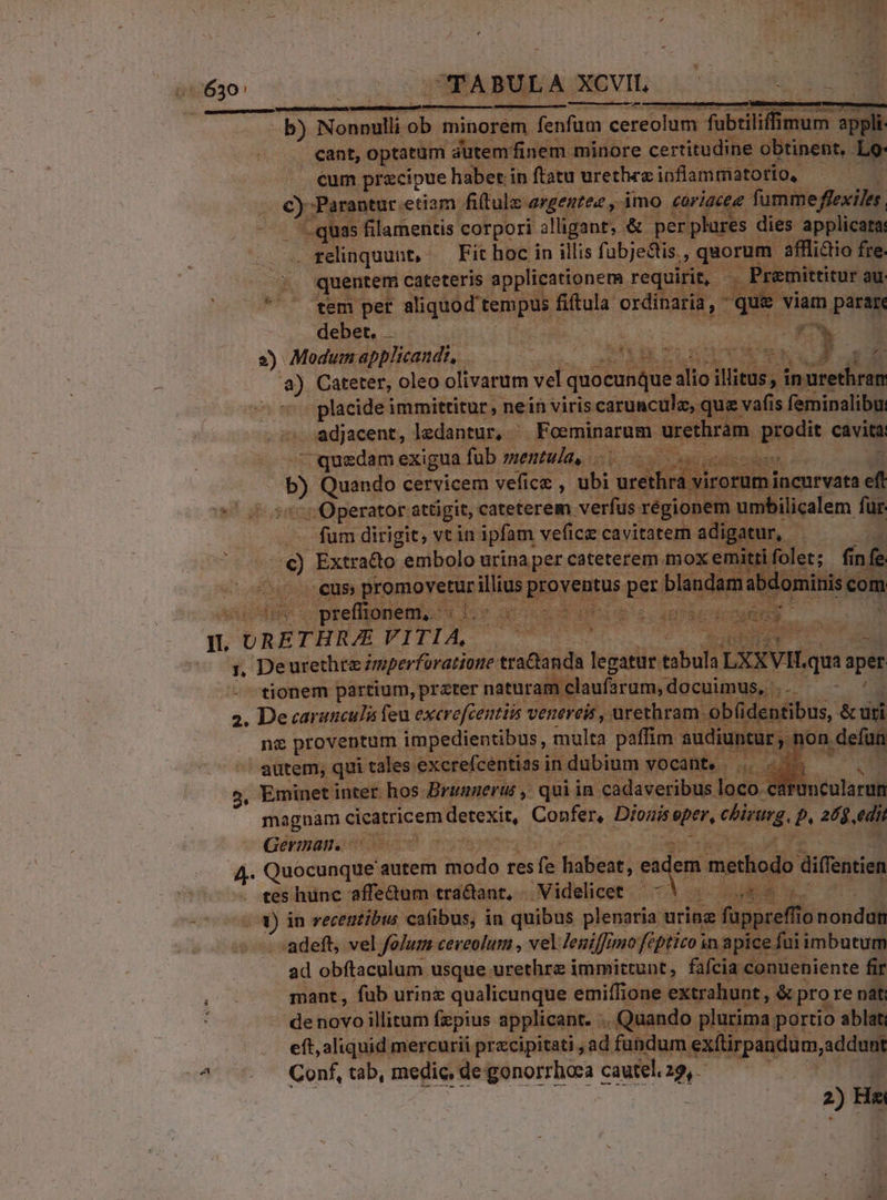 630: m CTABULA XCVIL : b) Nonnulli ob minorem fenfum cereolum fubtilifimum appli. cant, optatum autemfinem minore certitudine obtinent, Lo: cum przcipue haber. in ftatu urethea ipflammatorio, D C)-Parantur etiam fiftulz argenrez y imo «óriacee fumme flexiles. quas filamentis corpori alligant, &amp; per plures dies applicata: . relinquunt, — Fit hoc in illis fubjectis., quorum affli&amp;tio fre. quentem cateteris applicationem requirit, Premittitur au tem per aliquod tempus fiftula ordinaria,  que viam parare debet. . 2*7 98. 2) Modum applicandi, JI c EB CIE RUM os à) Cateter, oleo olivarum vel quocunque alio illitus, inurethram placide immittitur , nein viris carunculz, quz vafis feminalibu: adjacent, ledantur, ^ Foeminarum urethràm prodit cavita - quedam exigua fub mentula, a POT Te di b) Quando cervicem vefice , ubi urethra virorum incurvata eft ^«^. Operator attigit, cateterem verfus régionem umbilicalem fur. fum dirigit, vt in ipfam veficz cavitatem adigatur, » -€) Extrado embolo urinaper cateterem mox emitrifolet; finfe us, promovetur illius proventus per blandam abdominis com 1: E T Fu m t MR preffionem,. Wivr aUa d XH e o. d REC PIER I URETHR/AE VITIA, | AB REM 1, Deurethra zmperforatione tra&amp;anda legatur tabula LXXVH.qua aper - tionem partium, przter naturam claufarum, docuimus, ,. - ^ 2. De«caranculi feu excrefcentiis venereis , urethram ob(identibus, &amp; uri ne proventum impedientibus, multa paffim audiuntur ngon. defun autem, qui tales excrefcentias in dubium vocant... «7 — i 5, Eminetinter hos Broanerui ,. qui in cadaveribus loco. catuncularun magnam cicatricem detexit, Confer, Dionis eper, chirurg, p, 26$ edit German. | | C E / 4. Quocunque autem modo res fe habeat, pon methodo diffentien tes hunc affedum tractant, Videlicet. — — E s v 3) in recentibus cafibus, in quibus plenaria urinz füppreffionondun adeft, vel folum ceveolum , vel Jeniffono féptico in apice fui imbutum ad obftaculum usque urethre immittunt, fafcia conueniente fir mant , fub urinz qualicunque emiffione extrahunt, &amp; pro re nat; de novo illitum fzpius applicant. . Quando plurima portio ablat; eft, aliquid mercurii przcipitati , ad fundum exítirpandum, addunt ^ — GQonf,tab, medic degonorrhoa cautel29,.— — ORO NS