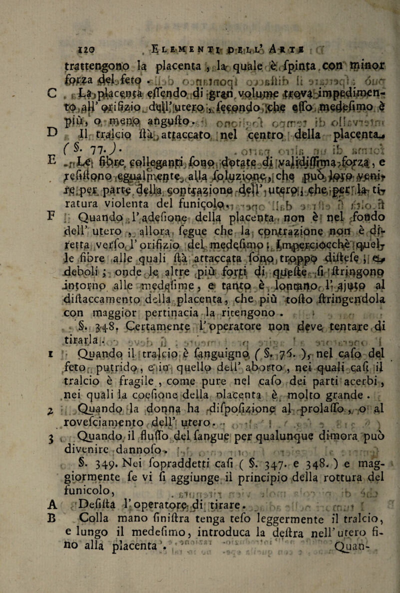 trattengono la placenta , la- quale è fp.inta.con minor del feto . oanelnoqi omftib ft aijpjaqlfi 6; ~ C , , J.à}placenta emendo di gr^n volume trqva impedimen¬ to,# prifiaio d^utero , fecondo ,che e(To medefimo è piu, o nienp. afi r*T ».ì t _ . w_feti Oliorigol oqrrm ih oIL&v D II tralcio ftà> attaccato, nel centro della placenta^ 77*^* . omq oulc jjjì ih ftfmoì , /efiftpno tegaalpì^te^aUa ch<| ffuq^p#pni* i^ip^r part$;3^ tb ratura violenta del funicoli ^o; '.Uh > ; > il E Quando • i’ adefione della placenta . non è nel fondo dell5 utero , allora fegue che la contrazione non è di¬ retta vedoj5 orifizio del me^frmp ^Jnaperciocchèiicjue^r le fibre alle quali ftà attaccata fono troppo diftefe ; zl? - deboli ; onde le altre più forfi $3 ;fi ftringonp intotnp alle medqfime , e tanto è lontano, I’ajtfto al dillaccamento della placenta, che più torto ftringendola con maggior pertinacia la ritengono. ; §. 348, Certamente T operatore non deve tentare di tirarla u t 1 f *3'K ì/^jCK' 1 • Quando il trajeio è fanguignd. ( §. 75. )r nei cafo del feto putrido, e;:in quello dell5 aborto , nei quali cafi il tralcio è fragile , come pure nel cafo dei parti acerbi, nei quali la coefione della olacenta è molto grande . I Quando la donna ha difpofizionp al prolaflb .o al rovefeiamento dell5: utero. ■ 4 j 3 v Quando; il fluffo del fangue per qualunque dimora può divenire dannofo* j-.\ 4 v , §. 349. Nei fopraddetti cafi ( §. 347. e 348. ) e mag¬ giormente fe vi fi aggiungevi principio della rottura del funicolo, 1 . ,i^ofl A Dedita 1-operatore di tirare. .. ;£>* slbn nctnuJ 1 B Colla mano finiftra tenga tefo leggermente il tralcio, e lungo il medefimo, introduca la delira nell'utero fi¬ no alla placenta1. ^ 1 O'M Quan-