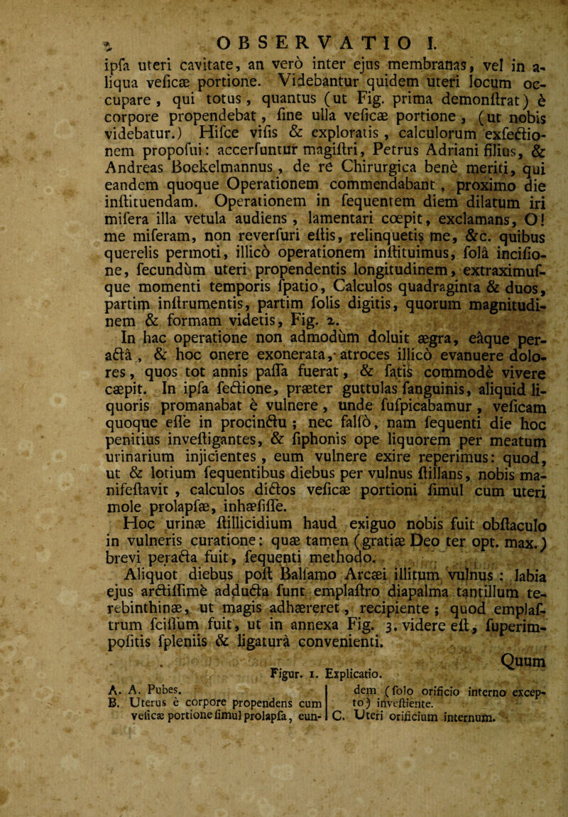 ipfa uteri cavitate, an vero inter ejus membranas, vel in a- liqua veficae portione. Videbantur quidem uteri locum oc¬ cupare , qui totus, quantus (ut Fig. prima demonftrat) £ corpore propendebat, fine ulla veficae portione , (ut nobis videbatur.) Hifce vifis & exploratis, calculorum exfeftio- nem propofui: accerfuntur magiftri, Petrus Adriani filius, & Andreas Boekelmannus, de re Chirurgica ben& meriti, qui eandem quoque Operationem commendabant, proximo die inftituendam. Operationem in fequentem diem dilatum iri milera illa vetula audiens, lamentari coepit, exclamans, O! me miferam, non reverfuri efiis, relinquetis me, &c. quibus querelis permoti, illicb operationem inftituimus, fola incifio- ne, fecundum uteri propendentis longitudinem > extraximuf- que momenti temporis /patio, Calculos quadraginta & duos, partim inftrumentis, partim folis digitis, quorum magnitudi¬ nem & formam videtis, Fig. x. In hac operatione non admodum doluit aegra, eaque per- afta , & hoc onere exonerata,- atroces illico evanuere dolo¬ res , quos tot annis pafla fuerat, & fatis commodi vivere caepit. In ipfa feftione, praeter guttulas fanguinis, aliquid li¬ quoris promanabat e vulnere , unde fufpicabamur , veficam quoque efle in procinftu ; nec fallo, nam fequenti die hoc penitius invefligantes, & fiphonis ope liquorem per meatum urinarium injicientes, eum vulnere exire reperimus: quod, ut & lotium fequentibus diebus per vulnus ftillans, nobis ma- nifeftavit , calculos dirios veficae portioni fimul cum uteri mole prolapfae, inhaelifle. Hoc urinae ftillicidium haud exiguo nobis fuit obftaculo in vulneris curatione: quae tamen (gratiaeDeo ter opt. max. j brevi peracta fuit, fequenti methodo. Aliquot diebus poli Baliamo Arcaei illitum vulnus : labia ejus arftiffimk addufta funt emplaftro diapalma tantillum te¬ rebinthinae, ut magis adhaereret, recipiente 5 quod emplaf- trum fcilfum fuit , ut in annexa Fig. 3. videre ell, fuperim- pofitis fpleniis & ligatura convenienti. Quum Figur. 1. Explicatio. A. A. Pubes. B. Uterus e corpore propendens cum veficae portione limul prolapfa, eun¬ dem (folo orificio interno excep¬ to) inveftiente. t C. Uteri orificium internum.