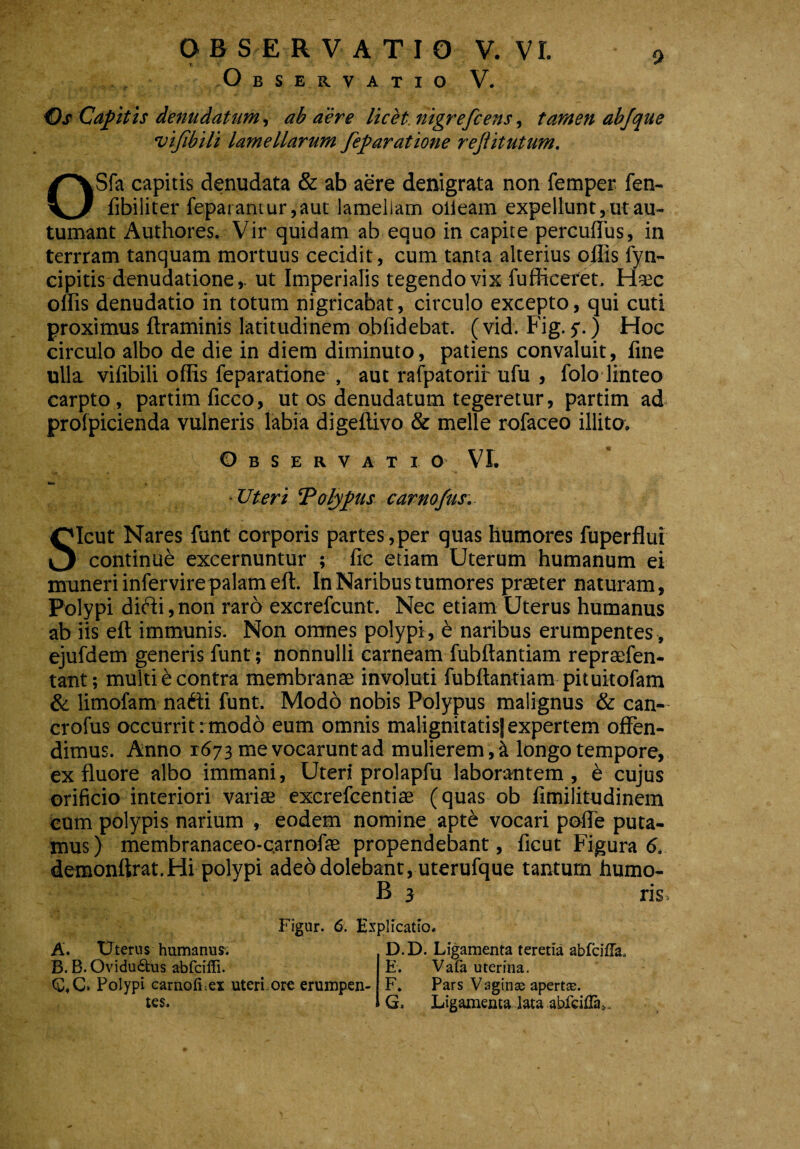 Observatio V. Os Capitis denudatum, ab aere licet, nigrefcens, tamen abjque vijibili lamellarum fep aratione rejlitutum. OSfa capitis denudata & ab aere denigrata non femper fen- fibiliter feparantur,aut lamellam olleam expellunt, ut au¬ tumant Authores. Vir quidam ab equo in capite percuffus, in terrram tanquam mortuus cecidit, cum tanta alterius offis fyn- cipitis denudatione,, ut Imperialis tegendo vix fuffieeret. Haec offis denudatio in totum nigricabat, circulo excepto, qui cuti proximus ftraminis latitudinem oblidebat, (vid. Fig. y.) Hoc circulo albo de die in diem diminuto, patiens convaluit, fine ulla vifibili offis feparatione , aut rafpatorii'ufu , folo linteo carpto, partim ficco, ut os denudatum tegeretur, partim ad profpicienda vulneris labia digeftivo & meile rofaceo illito. Observatio VI. Uteri ‘Polypus carno/us. Sicut Nares funt corporis partes,per quas humores fuperflut continub excernuntur ; fic etiam Uterum humanum ei muneri infervirepalam eft. In Naribus tumores praeter naturam, Polypi difti ,non raro excrefcunt. Nec etiam Uterus humanus ab iis eft immunis. Non omnes polypi, £ naribus erumpentes , ejufdem generis funt; nonnulli carneam fubftantiam repraefen- tant; multi e contra membranae involuti fubftantiam pituitofam & limofam nafti funt. Modo nobis Polypus malignus & can- crofus occurrit rmodo eum omnis malignitatisj expertem offen¬ dimus. Anno 1673 me vocarunt ad mulierem, k longo tempore, ex fluore albo immani, Uteri prolapfu laborantem, e cujus orificio interiori variae excrefcentiae (quas ob fimilitudinem cum polypis narium , eodem nomine apt^ vocari pofle puta¬ mus) membranaceo-carnofae propendebant, ficut Figura 6. demonftrat.Hi polypi adebdolebant, uterufque tantum humo- B 3 ris. Figur. 6. Explicatio» A. U tern s huma nu B. B. Ovidu£tus abfciffi. (£,C. Polypi carnoluex uteri ore erumpen¬ tes» D. D. Ligamenta teretia abfcifTa, E. Vafa uterina. F. Pars Vaginae apertas. G. Ligamenta lata abfciila>.