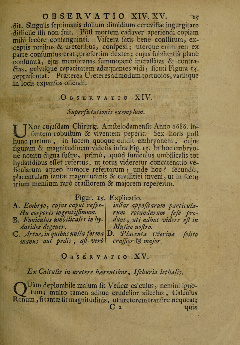 Ait. Singulis feptimanis dolium dimidium cerevifiae ingurgitare difficile illi non fuit. Poff mortem cadaver aperiendi copiam mihi fecere confanguinei. Vifcera fatis bene conftituta, ex¬ ceptis renibus & ureteribus, confpexi; uterque enim ren ex .parte confumtus erat,praefertim dexter; cujus fubffantia plane confumta, ejus membranas fummopere incraffatas & contra¬ das, pelvifque capacitatem adaequantes vidi; ficuti Figura 14. reprtsfentat. Praeterea Ureteres admodum tortuofos, variifque in locis expanfos offendi. O BSERVATIO XIV. S'uperfoetationis exemplum. UXor cujufdam Chirurgi Amftelodamenfis Anno 1686. in¬ fantem robuftum & viventem peperit. Sex horis poft hunc partum , in lucem quoque edidit embryonem , cujus figuram & magnitudinem videtis infra Fig.iy. In hoc embryo¬ ne notatu digna fuere, primo, quod funiculus umbilicalis tot hydatidibus effet refertus, ut totus videretur concatenatio ve- ficularum aqueo humore refertarum ; unde hoc ? fecundo, placentulam tantae magnitudinis & craffitiei inveni, ut in fbetu trium menfium raro crailiorem & majorem repererim. FIgur. ly. A. Embryo, cujus caput refpe- £lu corporis ingentijjimum. B. Funiculus umbilicalis inhy- datides degener. «C. Artus, in quibus nulla forma manus aut pedis , ajl verb Explicatio. in [far appofitarum particula¬ rum rotundarum Jefe pro¬ dunt , uti adhuc videre ejl in Mujko noflro. D. Placenta Uterina folito crajjlor © major. O B S ER V AT IO i XV. Ex Calculis in uretere haerentibus, Ifchuria lethalis. QUam deplorabile malum fit Veficae calculus, nemini igno¬ tum; multo tamen adhuc crudelior affedus, Calculus Kenum, fi tanta; fit magnitudinis, ut ureterem tranfire nequeat; C 2. quia