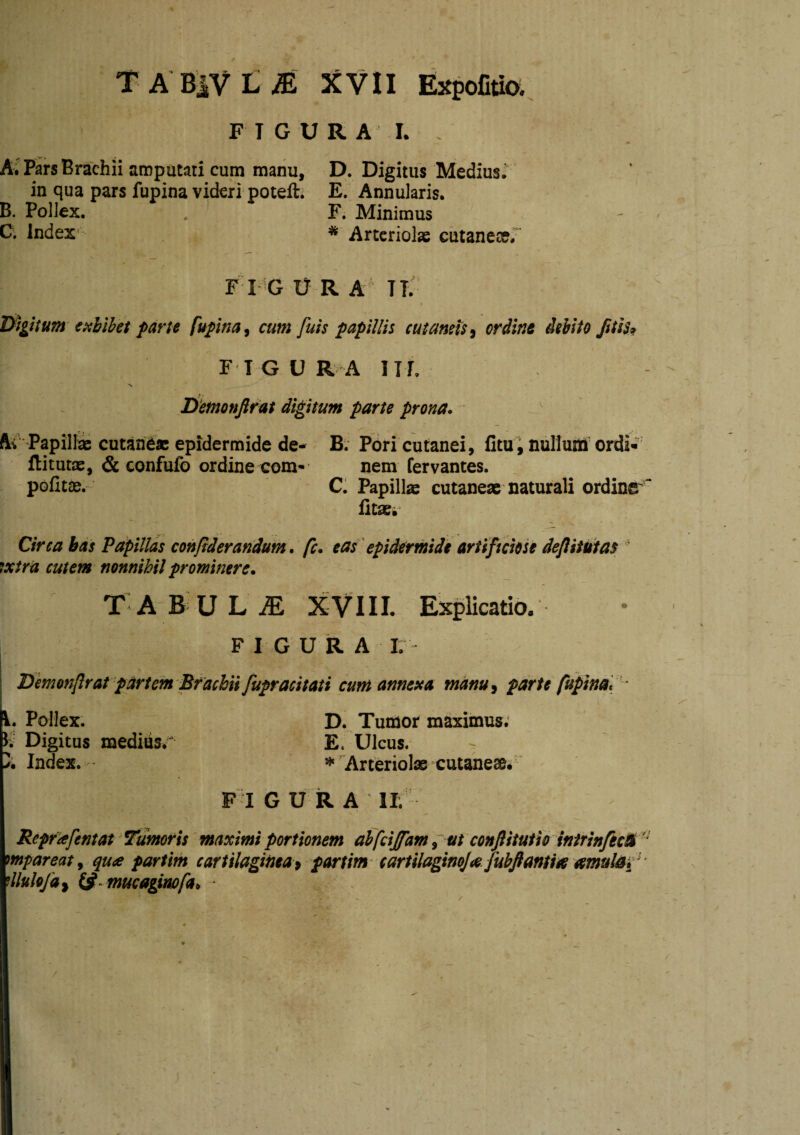 t a b:iVl;e xvn Expofiao. F T G U R A I. . m A; Pars Brachii amputati cum manu, D. Digitus Medius. in qua pars fupina videri potefti E. Annularis. B. Pollex. * F. Minimus C. Index^ * Arteriolae cutane?»/ F I G U R A ^ TT. J^igitum epiblhet parte fupina^ cum futs papillis cutamis^ ordine debito Jiti$9 F T G U R A Iir, N Detnonftrat digitum parte prona. ' Ai'Papilli cutan^» epidermide de- B. Pori cutanei, Ctui nullum'ordi«’ ftitutae, & confufo ordine com- nem fervantes. pofitae.- C. Papillie cutane» naturali ordine^ iltaei’ Cirea bas Papillas conjtderandum. fc. ea f epidermide artiftciose de/lstufas ’ ixtrii cutem nonnihil prominere. TABULM XVIII. Explicatio. F I G u R A L Dmonjlrat partem Brachii fupracitati eunt ame:«a manut parte fupina, ■ V. Pollex. D. Tumor maximus; I; Digitus mediusr E. Ulcus. - J; Index. ^ Arteriolas cutaneae. FIGURA ir. Reprafentat Tumoris maximi portionem alfeiffam f ut conjlitutio intrin/ecU  mpareat^ qua pariim cartilaginea^ partime artilagimja jubftantitie amula f' ^llulofa^ (^ mucagimfa^ * 1