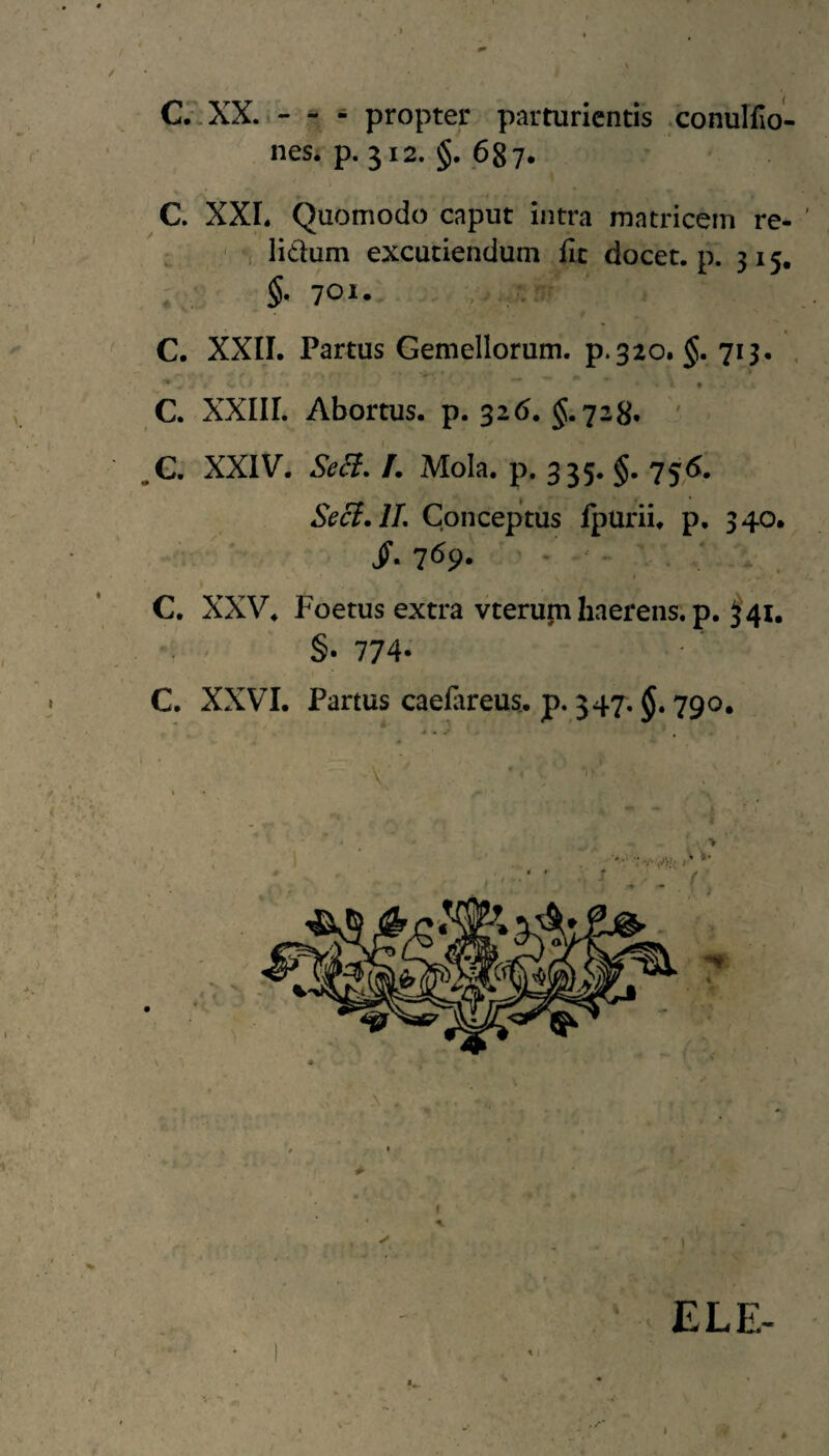 C.\XX.i- ^ - propter parturientis .conullio- nesi p. 312. §. 687. C. XXL Quomodo caput intra matricem re- lidum excutiendum fic docet, p. 315, $. 701. C. XXIL Partus Gemellorum, p.320. 713, . C. XXIIL Abortus, p. 326. $.728. ' ^G. XXIV. SeSf, /. Mola, p. 335. §. 75,<^. Seci.lL Conceptus fpurii. p. 340. i- 1^9- ' ‘ . . C, XXV. Foetus extra vterum haerens, p. ^41, §. 774- C. XXVI. Partus caelareus. p. 347. 790. * •• • , A • . .\ ELE-