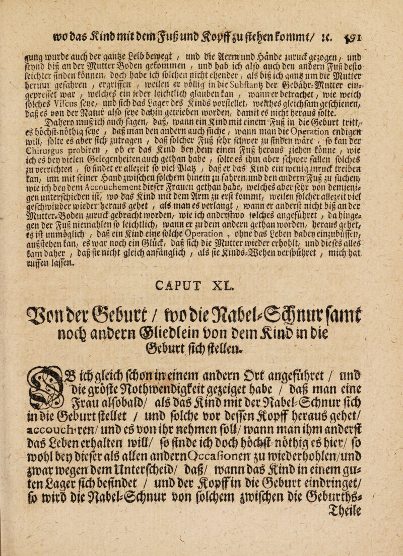 wobas jfinömitöem Jufjunö ÄovfFfu fielenfommt/ u. isi mutbe aucö bet ^et^6emec;t , nnb W gemimt) .franbe mruefgem^n/ mb fepnb big an ber Butter SBoben gefommen , unbpab id) alfo attd)ben anoern gug beflo reichtet ftnben fonnem bod) l>at>e idj fbjepen niept ebenbet4, alß big id) gani um bie Butter herum gefahren , ergriffen , metlen et ooüig inbteSubftan^ bet #> e öd l; r' fOe ult er eit?** gepreßt mar , melcpe| einnber kiditlid) glauben fan , mannerbetraepet/ mie meid) fofcpeS Vifeus fei)C/ nnb ftd) baß Vage? btß &inb6 oor gellet/ meltpe^ gläepfamgefepienen/ bag tß oon ber Btatur alfo fepe batnn getrieben morbeti/ bamit cß niept peraul folte. ©aprero mtigtcp auep ftgeu/ bag/ mann ein ^'tnb mit einem^ug in bie Geburt trittr eß poepgmotpig fepe , bag man beu anbern and) fitcpe / mann man bie Operation enbiger miß, folte tß öber ftep ^tragen / bag folget4 gug fepr fernerju jtnben mdre / fo fan ber Chirurgus probireti f ob er baß finb §epsbem einen gug peraim pepen fonne, mie id) e^ bet) otden (^clegenpeifenaucpgetpanpabe , folte tß tpm aber fepmer fallen foldje^ p oerriepteü , fofinbet er allezeit fooiei3Ma§ , bagerba3 Smb einrmentgptud treiben tan, um mit feiner £anb$wifcpenfotcpem pinein|ufdprm/tmb benanberngug p fuepetp mie icp bet) bernAccouchementbiefer grauen getpanpabey melcpe^aberfepr oon bemieni? gen imterfcpieben i|17 m ba£ jfinb mit bem 3(rm ju erg fommt/ rnetlen folcper allezeit rief gefcpminber mieber peratm gepet / al$ man tß oerlangt K mann er anberg nieptbig an ber SKutter^obeniurucf gebrad)tmorbeti/ mie icp anbergmo felcpeg angefupret, ba hinge* gen ber gug niemaplen fo kid)t\xd)i mann er prbem anbern getpan morben, perauä gepet/ tß ig unmöglich , bag ein $inb eine foldje Operation , opne b<$ Oeben habet) eipubuffetr/ auggepenfau/ e$mar nocpem@lud/ bag fiep bie Butter miebererpoplt/ nnb biefe3 alle** fam baper t bag ge niept gleicp anfdnalicp / alß ge jtdub&Sepm oerfpupret, miep pat mtpAi lagern ' . V V; GlPUT XL Q5en ber ©ebtta / mo bie 9?abe^@® nur famf noep anbern ©liebfein Oon bem Äb in bie ©elutt lief) flcUcti. icf)gi'eicf)f<f)onineinem anfcem DU angefttltet f tmb Die geölte StTotpmenOtQfcttgejeiget labe / l>afj man eine Scan otfoktt)/ all öaö 5tlnt> mit Der 9Tal'et6ct)nnc ftcl) in Bie ©ebnet fiettet / unt) folctje toot OctTen Jtopff petauö ßepet/ accouchiten/ uni) e6 toni^c nehmen foü/ mann man tpm anfcetti Daö ScUenecpalten mitt/ fo ftnDe icp t»ocp pocUff notbiq picr/ fo tt»ot)l bet) brefet aI6 aUen anbemOccaiionen ju mieOcrpüpten/unP pum wegen bem Untetfcbeib/ baf / wann bas Äinb in einem gm ten ßaget lief) beftnbet / unb bet ,fop|fin bie ©ebnet einbringet/ fo wieb bie 9tabel^0nue bon fofebem pifeben bie ©ebnetb^ ; ' - ^beife