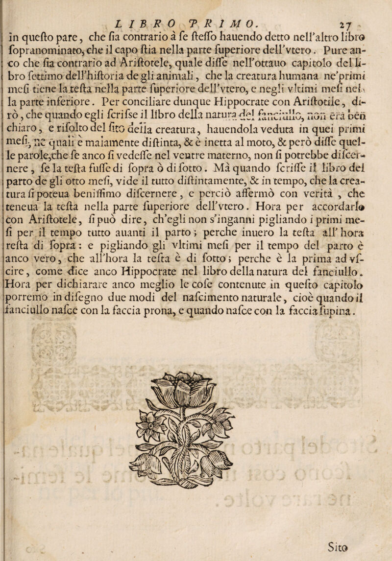 i In quefto pare, che fia contrario à fé fteffo hauendo detto nell’altro libro ì fopranominato, che il capo ftia nella parte fuperiore deirvtero. Pure ari- : co che fia contrario ad Àriftotele, quale diffe neU’ottauo capitolo del li- ( bro fettimo deirhiftoria de gli animali, che la creatura humana ne’prirm i me fi tiene la tefta nella parte fuperiore deirvtero, e negli virimi me fi ncf la parte inferiore. Per conciliare dunque Hippocrate con Ariftotiie, di- \ rò, che quando egli fcrifse il libro della natura del fanciullo, HOn era oen [chiaro, e rifolto del fico della creatura, hauendola veduta in quei primi • mefij nc quali è malamente diftinta, & è inetta al moto, & però diffe quel- ; le parole,rhe fe anco fi vedelfe nel ventre materno, non fi potrebbe di ficee- nere, fela tefta fuffe di fopra ò di fiotto. Ma quando fc riffe il libro dei ; parto de gli otto meli, vide il tutto diftintamente, & in tempo, che la crea** : tura fi poteua beniffìmo difcernere, e perciò affermò con verità , che iteneua la tefta nella parte fuperiore dell’vtero. Hora per accordarla :con Àriftotele, fi può dire, ch’egli non sbnganni pigliando i primi me¬ li per il tempo tutto alianti il parto ; perche inuero la tefta all’ hora ìrefta di fopra : e pigliando gli virimi mefi per il tempo del parto è ianco vero, che all’hora la tefta è di fotto; perche è la prima ad vf- icire, come dice anco Hippocrate nel libro della natura del fanciullo. iHora per dichiarare anco meglio le cofe contenute in quefto capitolo [porremo indifegno due modi del nafcimento naturale, cioè quando il [fanciullo nafce con la faccia prona, e quando nafce con la faccia Topina.