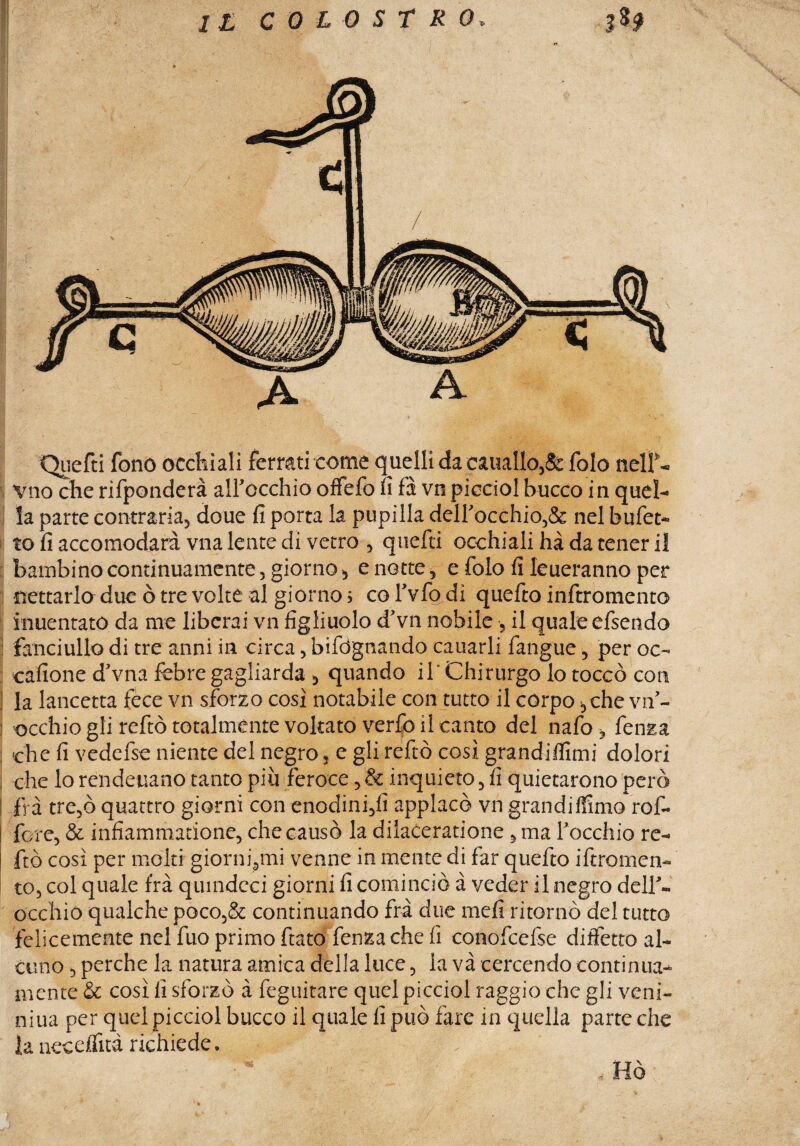 A Quefti fono occhiali ferrati come quelli da eauallo,fe fole nell*- Viio che rifponderà alFccchio offefo fi fà vn picciol bucco in quel-» la parte contraria, doue fi porta la pupilla delFocchio,& nel bufet- to fi accomodare vna lente di vetro , quefti occhiali hà da tener il bambino continuamente, giorno * e notte, e folo fi Ieueranno per nettarlo due ò tre volte ài giorno ? co Fvfo di quefto inftromento inuentato da me liberai vn figliuolo d'vn nobile , il quale efsendo fanciullo di tre anni in circa, bifdgnando cauarli fangaie, per oc- catione d'vna febre gagliarda , quando il Chirurgo lo toccò con la lancetta fece vn sforzo così notabile con tutto il corpo ,che vifi- 3 occhio gli reftò totalmente voltato verfo il canto del nafo ? fenza che fi vedefse niente del negro, e gli reftò così grandiffimi dolori che lo rendeuano tanto più feroce, & inquieto, fi quietarono però I irà tre,ò quattro giorni con enodini,fi applacò vn grandiffimo rof- ! fore, & infiammatione, che causò la dilaceratione , ma Focchio re¬ ftò così per molti giorni,mi venne in mente di far quefto iftromen- to, col quale fra qumdcci giorni fi cominciò à veder il negro deir- occhio qualche poco,& continuando fra due mefi ritornò del tutto felicemente nel fuo primo fiato fenzache fi conofcelse diffetto al¬ cuno , perche la natura amica della luce, la va cercendo continua- mente & così fi sforzò à feguitare quel picciol raggio che gli veni- niua per quel picciol bucco il quale fi può fare in quella parte che la neceffità richiede. , Hò