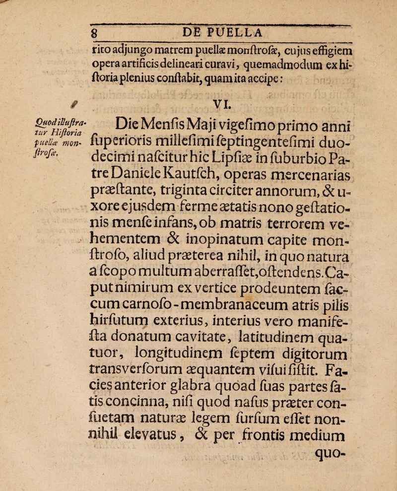 rito adjungo matrem puelk monflrofe, cujus effigiem opera artificis delineari curavi, quemadmodum exhi- floria plenius conflabit, quam ita accipe : fi VI. w/nfftlria Menfis Maji vigefimo primo anni fu elice mon- fuperioris millefimifeptingentefimi duo- fit-oje, decimi nafcitur hic Lipfiae in fuburbio Pa¬ tre Daniele Kautfch, operas mercenarias praeftante, triginta circiter annorum, & u- xore ejusdem ferme aetatis nono geftatio» nis menfe infans, ob matris terrorem ve¬ hementem Sc inopinatum capite mon- ftrofo, aliud praeterea nihil, in quo natura a fcopo multum aberrafTet,ofl:endens,Ca- put nimirum ex vertice prodeuntem fae¬ cum carnofo - membranaceum atris pilis hirfutum exterius, interius vero manife- fta donatum cavitate, latitudinem qua- tuor, longitudinem feptem digitorum transverforum aequantem vifui fiflit. Fa¬ cies anterior glabra quoad fuas partes fa¬ tis concinna, nifi quod nafus praeter con- fuetam naturae legem furfum efTet non¬ nihil elevatus, & per frontis medium quo-