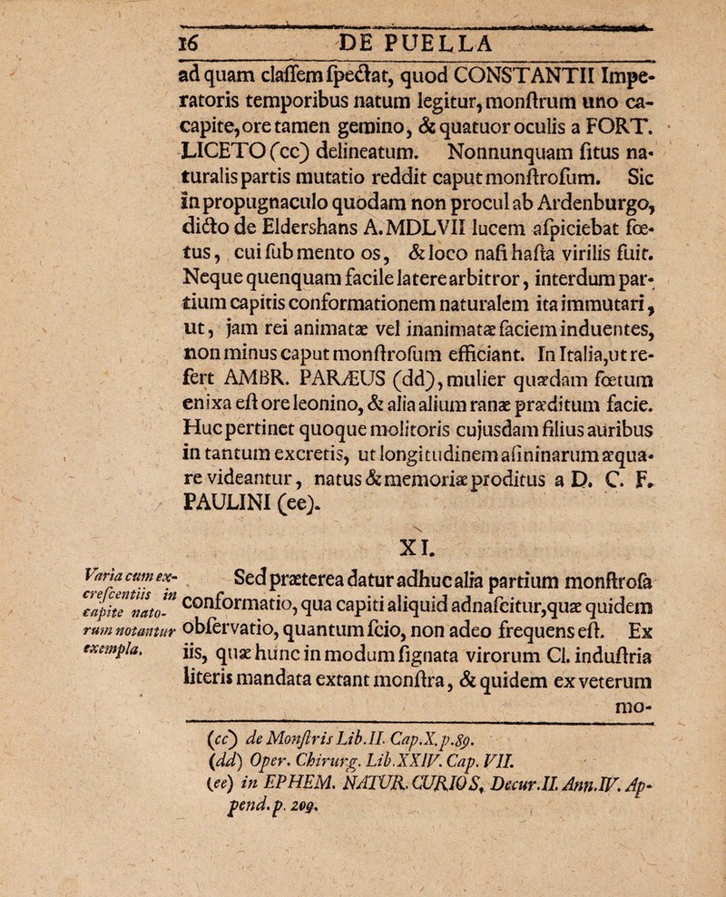 ad quam claffemfpe&at, quod CONSTANTII Impe¬ ratoris temporibus natum legitur, monftrum uno ca- capite,ore tamen gemino, &quatuor oculis a FORT. LICETO fcc) delineatum. Nonnunquam fitus na¬ turalis partis mutatio reddit caput monftrofum. Sic in propugnaculo quodam non procul ab Ardenburgo, didlo de Eldershans A.MDLVII lucem afpiciebat foe¬ tus , cui fub mento os, & loco nafi hafta virilis fuit. Neque quenquam facile latere arbitror, interdum par¬ tium capitis conformationem naturalem ita immutari, ut, jam rei animatae vel inanimataefacieminduentes, non minus caput monfirofum efficiant. In Italia,ut re¬ fert AMBR. PARiEUS (dd),mulier quaedam foetum enixa eft ore leonino, & alia alium ranae praeditum facie. Huc pertinet quoque molitoris cujusdam filius auribus in tantum excretis, ut longitudinem afininarum aequa¬ re videantur, natus & memoriae proditus a D. C F» PAULINI (ee> XI. lana cum ex- Sed praeterea datur adhuc alra partium monftrcfa VapitTnato* confora*atio, qua capiti aliquid adnafcitur,quae quidem rum notantur obfervatio, quantum fcio, non adeo frequens efL Ex exempla* fis, qu^ hunc in modum fignata virorum Cl. induftria literis mandata extant monftra, & quidem ex veterum mo- (cc) de Monftris Lib.IL Cap.X.p.fy. (dd) Oper. Chirurg. Lib.XXIV. Cap. VII. (ee) in EPHEM, NATUR. CURIO Sf Decur.il Ann.IV. Ap- pend.p.2o$.