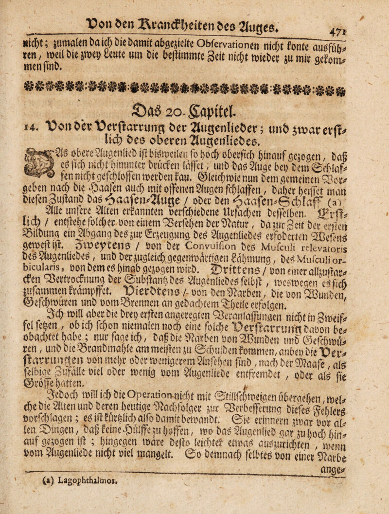 14. nicht; inmaUn&rti^bicbötnitöbgejtcfteObfervationen nicftt fonte aiüfüS w, weil die }«w ßeute um die bcftisnmtc gcit nrc^t n>iedee tu mir qefönu menftnb. 20. gapttel T>ondh*t>erffammi? dev 2lugenlieder; und jwarevfo Heb des oberen 2lugen'!iedes. gSfS obere^ugenlted ij] bisweilen ft hoch obevficb hinauf getogen, baß ■ * es |tcf) »i^munfcr btücPen (äffet, uni) bas 2lugc bet) Dem ©dhlafc fen nicfn gefchloffen werden fau. ©letchmie nun Dem gemeinen Sftt* geben nach dte -Öaafen auch mit offenen Slugen fchiaffen, habet buffet man diefen gufiand basoaafe»4luge / oder Den 6a«fen*©cbfa# h > 2((le unfete Silten etFannten oerfebtedene Urfachen hejfeiben. ' 'l&tw Heb / entfiele folcher dort einem Sßerfeben der 3?atur, däjurgeit bernlc« Söildttna ein Abgang beS jue (gejeugung des Sfogetiliedes etfohetteh wknt gemeft iff. _3voeytens / öon der Convulfion beS Mufculi Elevator« heö Slugenlsedes, unh der jugleich.gegenwärtigen Zähmung, des Mufculi or- biculans, öon hem es hinab gejogen mich, drittens / von einer aliiuftat* «&» SSeeftotfnung der ©ubjlanh de£ SluglnliedeS feibfi, weswegen eißch jufammen Ftampffet. Vterdtens /■ oon hen Farben, hie öon ^Bünden ©efchwucen unh Domtrennen an gehabtem ^heile erfolgen. ” ' 3ch tritt aber hie drei; erflen angeregten ^eraniafftnsen nicht in gwetft feifehen / ob ich fcoott mentalen noch eine foiefte ^erflarruif« dabon be» obachtet habt; nur fage ich / baf hie Farben öon Stunden unh ©efchwü* ren, unh die vSrandmahle ammeifienju ©dmibenFommen, anbei» bie't>etv ffammgen von mehr oder wenigerem 2lnfehen find, nach her 9)?aafe, alö felbige Sufatte viel ober wenig vom ?ittgen(iehe entfremdet , ober als fe ©rojfe hatten. t ' 3eboch will kl) hieOperation-nicht mit ©tsllfchwetgen ubergehen, mtb che hie eilten unh deren heutige Nachfolger jur fSerbeffetung diefeS fteläcrf? »orfchlagen; es ifi Fjirlltch aifo hamit bewandt. Bk erinnern twar Vor al¬ len Singen, dag feine fDülffe ja hoffen, wo das Slngenlied m ju hoch imu auf gejogen ifi ; hingegen wäre deffo leichte! etwas aasjuriehten , wenn vom Slugenliehe nicht viel mangelt. 6o demnach felbtes von einer 0?arbe —--—___ anqe* (a) Lagophthalmos»