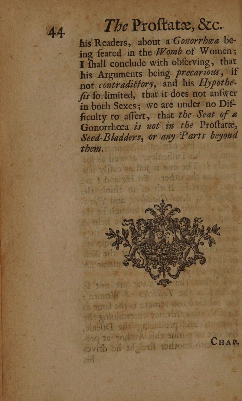 his Arguments being precarious, if not contradittory, and his Hypothe- fis fovlimited, that ic does not anfwer in both Sexes; we are under’ no Dif ficulty to: affert, that the Seat of a Gonorrhoea is uot im the Proftate, ety aai€ NY S q EE
