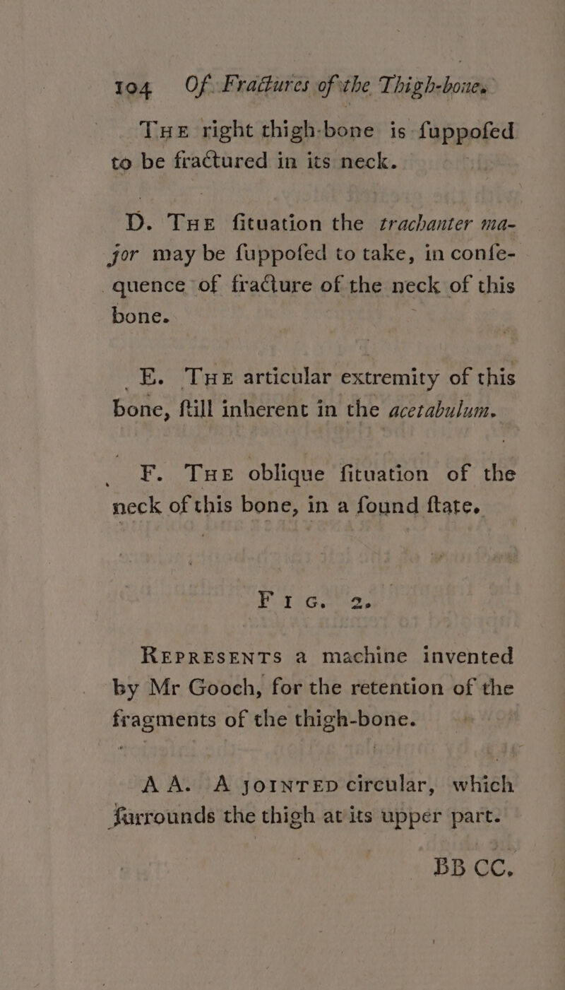 Tue right thigh-bone is fuppeied to be fractured in its neck. D. Tue fituation the trachanter ma- jor may be fuppofed to take, in confe- quence of fracture of the neck of this bone. _E. Tue articular extremity of this bone, ftill inherent in the acetabulum. ee rahioe bys fs oblique fituation of the meck of this bone, in a found ftate. Poi te, REPRESENTS a machine invented by Mr Gooch, for the retention of the fragments of the thigh-bone. A A. A jornrep circular, which farrounds the thigh at its upper part. BB CC,