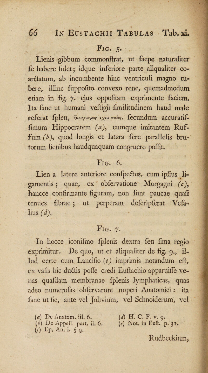 Fig. 5. Lienis gibbum commonftrat, ut faepe naturaliter fe habere lolet; idque inferiore parte aliqualiter co¬ artatum, ab incumbente hinc ventriculi magno tu¬ bere, illinc fuppofito- convexo rene, quemadmodum etiam in fig. 7. ejus oppofitam exprimente faciem. Xta fane ut humani veftigii fimilitudinem haud male referat fplen, o/u.oiopvafx.05 rtoSog, fecundum accuratifi finium Hippocratem (a), eumque imitantem Ruf- fum (b), quod longis et latera fere parallelis bru» torum lienibus haudquaquam congruere poffit. Fig. 6. Lien a latere anteriore confpe&us, cum ipfius li¬ gamentis ; quae, ex obfervatione Morgagni (c)9 hancce confirmante figuram, non funt paucae quajfi tenues fibrae; ut perperam deferipferat Veia- lius (d), Fig. 7. In hocce. iconifmo iplenis dextra feu fima regio exprimitur. De quo, ut et aliqualiter de fig. 9., il¬ lud certe cum Lancifio (e) imprimis notandum efi, cx vafis hic duftis pofie credi Euftachio apparuifie ve¬ nas quafdam membranae fplenis lymphaticas, quas adeo numerofas obfervarunt nuperi Anatomici: ita fane ut fic, ante vel Jolivium, vel Sehnoiderum, vel (a) De Anatom. iii. 6. (d) H. C. F„ v. 9. (b) De Appell. part. ii. 6. (e) Not. in Euft. p. 31. (c) Ep. An. i. § 9, Rudbeckium,