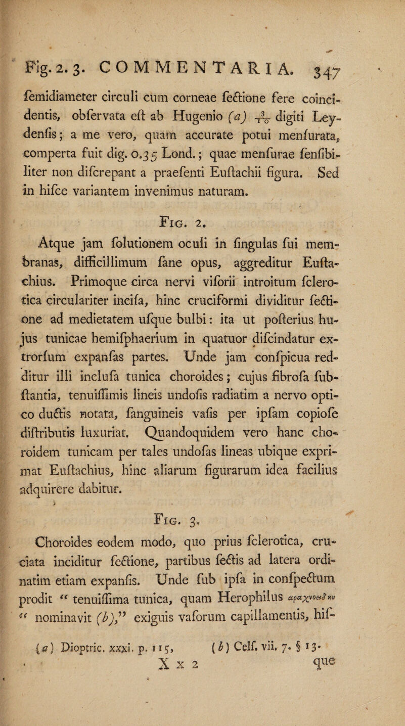 femidiameter circuli cum corneae fe&ione fere coinci- dentis, obfervata eft ab Hugenio (a) -t- digiti Ley- denfis; a me vero, quam accurate potui menfurata, comperta fuit dig. 0.3 5 Lond.; quae menfurae fenfibi- liter non difcrepant a praefenti Euftachii figura. Sed in hifce variantem invenimus naturam. Fio. 2. Atque jam folutionem ocuii in fingulas fui mem¬ branas, difficillimum fane opus, aggreditur Eufta- chius. Primoque circa nervi viforii introitum fclero- tica circulariter incifa, hinc cruciformi dividitur fe£fi- one ad medietatem ufque bulbi: ita ut pofierius hu¬ jus tunicae hemifphaerium in quatuor difcindatur ex- trorfum expanfas partes. Unde jam confpicua red¬ ditur illi inclufa tunica choroides; cujus fibrofa fub- fiantia, tenuilfimis lineis undofis radiatim a nervo opti¬ co du&is notata, fanguineis vafis per ipfam copiofe diffributis luxuriat. Quandoquidem vero hanc cho-* roidem tunicam per tales undo fas lineas ubique expri¬ mat Euftachius, hinc aliarum figurarum idea facilius adquirere dabitur. A Fig. 3, Choroides eodem modo, quo prius fclerotica, cru¬ ciata inciditur fe&ione, partibus fe&is ad latera ordi- natim etiam expanfis. Unde fub ipfa in confpe&um prodit “ tenuifiima tunica, quam Herophilus u?*xvoe**w c( nominavit (b)” exiguis vaforum capillamentis, hif- {<?) Dioptric. xxxi. p. (b) Celf vii. 7* § *3- X X 2 que