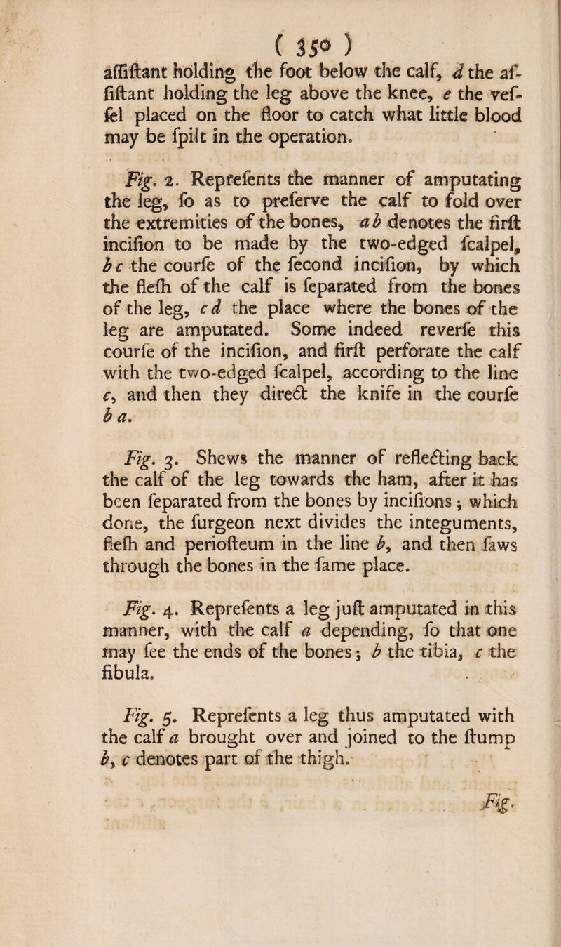 ( 35° ) affiftant holding the foot below the calf, d the af¬ fiftant holding the leg above the knee, e the vef- fel placed on the floor to catch what little blood may be fpiit in the operation., Fig. 2. Reprefents the manner of amputating the leg, fo as to preferve the calf to fold over the extremities of the bones, a h denotes the firft incifion to be made by the two-edged fcalpel, b c the courfe of the fecond incifion, by which the flefh of the calf is feparated from the bones of the leg, c d the place where the bones of the leg are amputated. Some indeed reverfe this courfe of the inciflon, and firft perforate the calf with the two-edged fcalpel, according to the line c, and then they dired the knife in the courfe h a. Fig. 3. Shews the manner of refleding back the calf of the leg towards the ham, after it has been feparated from the bones by incifions; which done, the furgeon next divides the integuments, flefli and periofteum in the line £, and then faws through the bones in the fame place. Fig. 4. Reprefents a leg juft amputated in this manner, with the calf a depending, fo that one may fee the ends of the bones; b the tibia, c the fibula. Fig. 5. Reprefents a leg thus amputated with the calf a brought over and joined to the flump by c denotes part of the thigh.