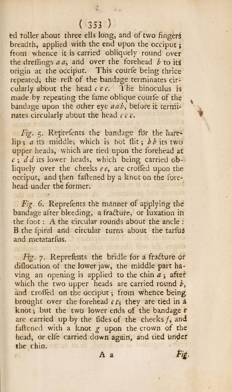 fed roller about three ells long, and of two fingers breadth, applied with the end upon the occiput j from whence it is carried obliquely round over the drefiings aa^ arid over the forehead b to hi origin at the occiput. This coilrfe being thrice repeated* the reft of the bandage terminates cir¬ cularly about the head c c c. The binoculus is made by repeating the fame oblique courfe of the bandage upon the other eye a a b, before it termi¬ nates circularly about the head cc'c. Fig. 5. Represents the bandage for the hare* lip % a its middle* which is riot flit; bb its two upper heads, which are tied upon the forehead at c; dd its lower heads, which being carried ob¬ liquely over the cheeks ee7 are crofted upon the occiput, and then faftened by a knot on the fore¬ head under the former. 0 Fig. 6. Reprefeflts the manner of applying the bandage after bleeding, a fradture, or luxation iii the foot: A the circular rourids about the ancle : B the fpiral arid circular turns about the tarfus and metatarfus. Fig. 7. Repreffents the bridle for a fradbure dr diflocation of the lower jaw, the middle part ha¬ ving an opening is applied to the chin a ; after which the two upper heads are carried round b7 and crofted on the occiput; from whence being brought over the forehead ct\ they are tied in a knot; but the two lower erids of the bandage t are carried up by the ftdes of the cheeks/, and faftened with a knot g upon the crown of the head, or elfe carried down again, and tied under the chin. A a Fig.