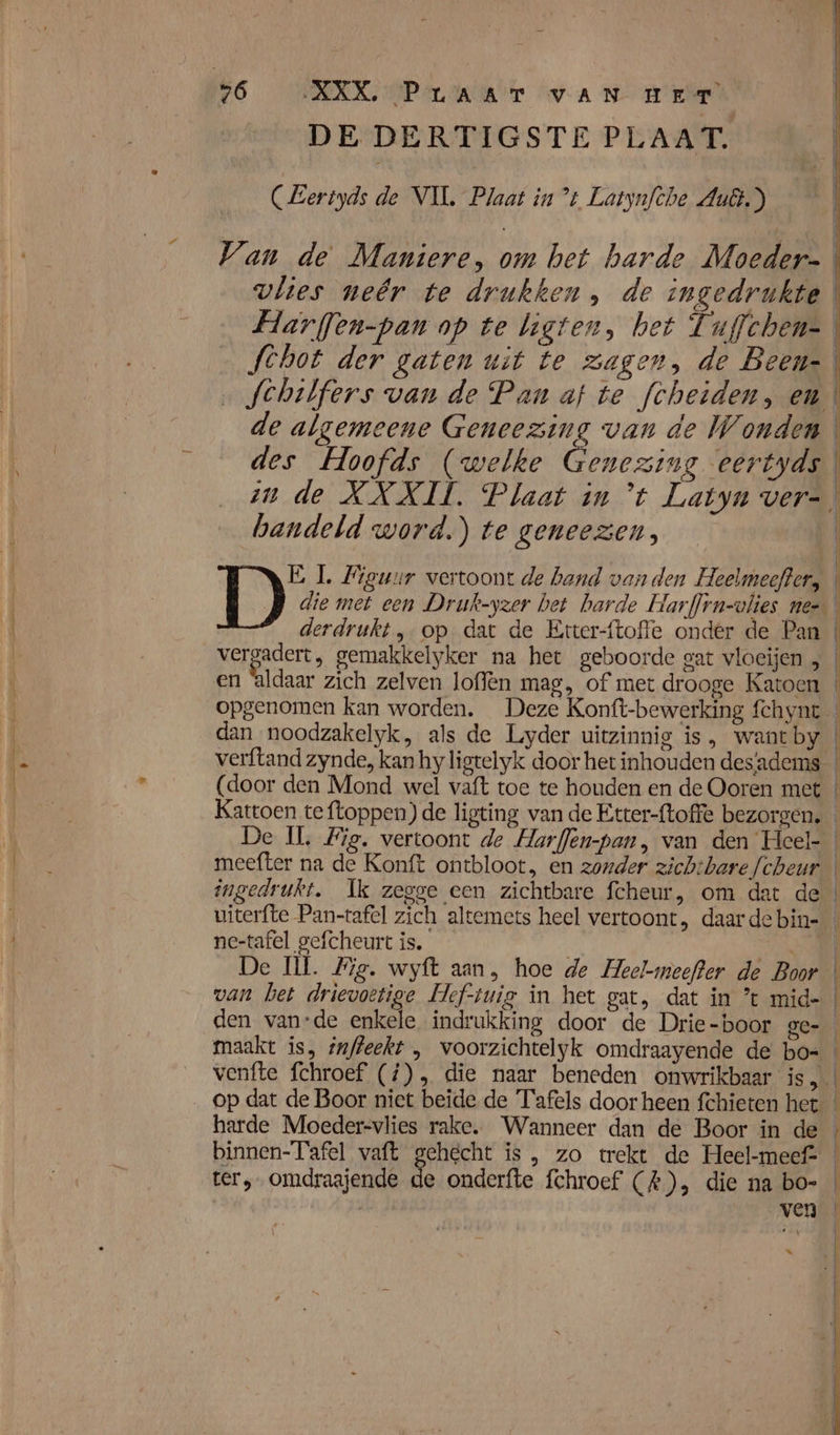 DE DERTIGSTE PLAAT. (Lertyds de VIL Plaat in ’t Latynfche Au.) handeld word.) te geneezen, dan noodzakelyk, als de Lyder uitzinnig is , want by verftand zynde, kan hy ligtelyk door het inhouden des‘adems De IL, Fig. vertoont de Harflen-pan, van den Heel- meefter na de Konft ontbloot, en zonder zichtbare fcheur ingedrukt. Ik zegge een zichtbare fcheur, om dat de ein aca ne-tafel gefcheurt is, De IL. Fig. wyft aan, hoe de Heel-meefter de Boor van bet drievoetige Hef-tuig in het gat, dat in ’t mid- den van-de enkele indrukking door de Drie-boor ge- ter, omdraajende de onderfte fchroef (#), die na bo- «