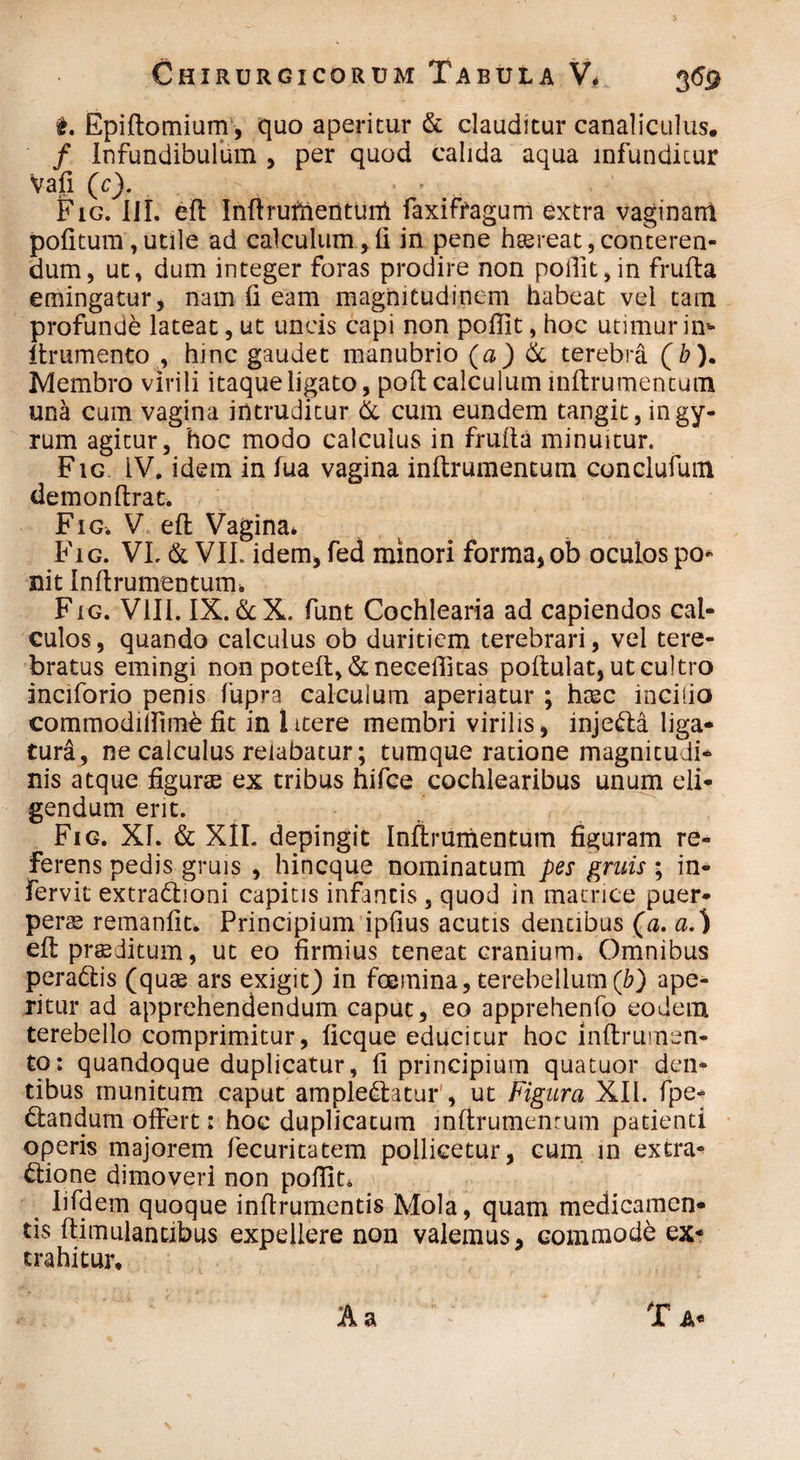 t. Epiftomium, quo aperitur & clauditur canaliculus. / Infundibulum , per quod calida aqua infunditur vafi (c). Fig. III. eft Inftruftieiituni faxiffagum extra vaginam politum, utile ad calculum, fi in pene h^reat,conteren¬ dum, ut, dum integer foras prodire non poffit,in frulta emingatur, nam li eam magnitudinem habeat vel tam profunde lateat, ut uncis capi non pollit, hoc utimur in* itrumento , hinc gaudet manubrio (a) 6c terebra (b). Membro virili itaque ligato, poli calculum lnftrumentum una cum vagina intruditur & cum eundem tangit, in gy¬ rum agitur, hoc modo calculus in frulta minuitur. Fig IV. idem in fua vagina inltrumentum conclufum demonftrat. Fig. V elt Vagina* Fig. VI. & VII. idem, fed minori forma, ob oculos po¬ nit Inltrumentum* Fig. VIII. IX. &X. funt Cochlearia ad capiendos cal¬ culos, quando calculus ob duritiem terebrari, vel tere¬ bratus emingi non poteflg&neceflitas poltulat, ut cultro inciforio penis fupra calcuium aperiatur ; htec incilio commodiirim& Iit in Ittere membri virilis, injedla liga¬ tura, ne calculus relabatur; tumque ratione magnitudi¬ nis atque figurae ex tribus hifce cochlearibus unum eli¬ gendum erit. Fig. XI. & XII. depingit Inltrumentum figuram re¬ ferens pedis gruis , hincque nominatum pes gruis; in- fervit extradioni capitis infmtis, quod in matrice puer¬ perae remanfit. Principium iplius acutis dentibus (a. eft praeditum, ut eo firmius teneat cranium* Omnibus peradtis (quae ars exigit) in fcemina, terebellum (b) ape¬ ritur ad apprehendendum caput, eo apprehenfo eodem terebello comprimitur, ficque educitur hoc inltrumen- to: quandoque duplicatur, fi principium quatuor den¬ tibus munitum caput ampledtatur , ut Figura XII. fpe- dtandum offert: hoc duplicatum inltrumentum patienti operis majorem fecuritatem pollicetur, cum in extra- dtione dimoveri non poflit* Iifdem quoque inflrumentis Mola, quam medicamen¬ tis Itimulantibus expellere non valemus, commode ex¬ trahitur, la Ta«