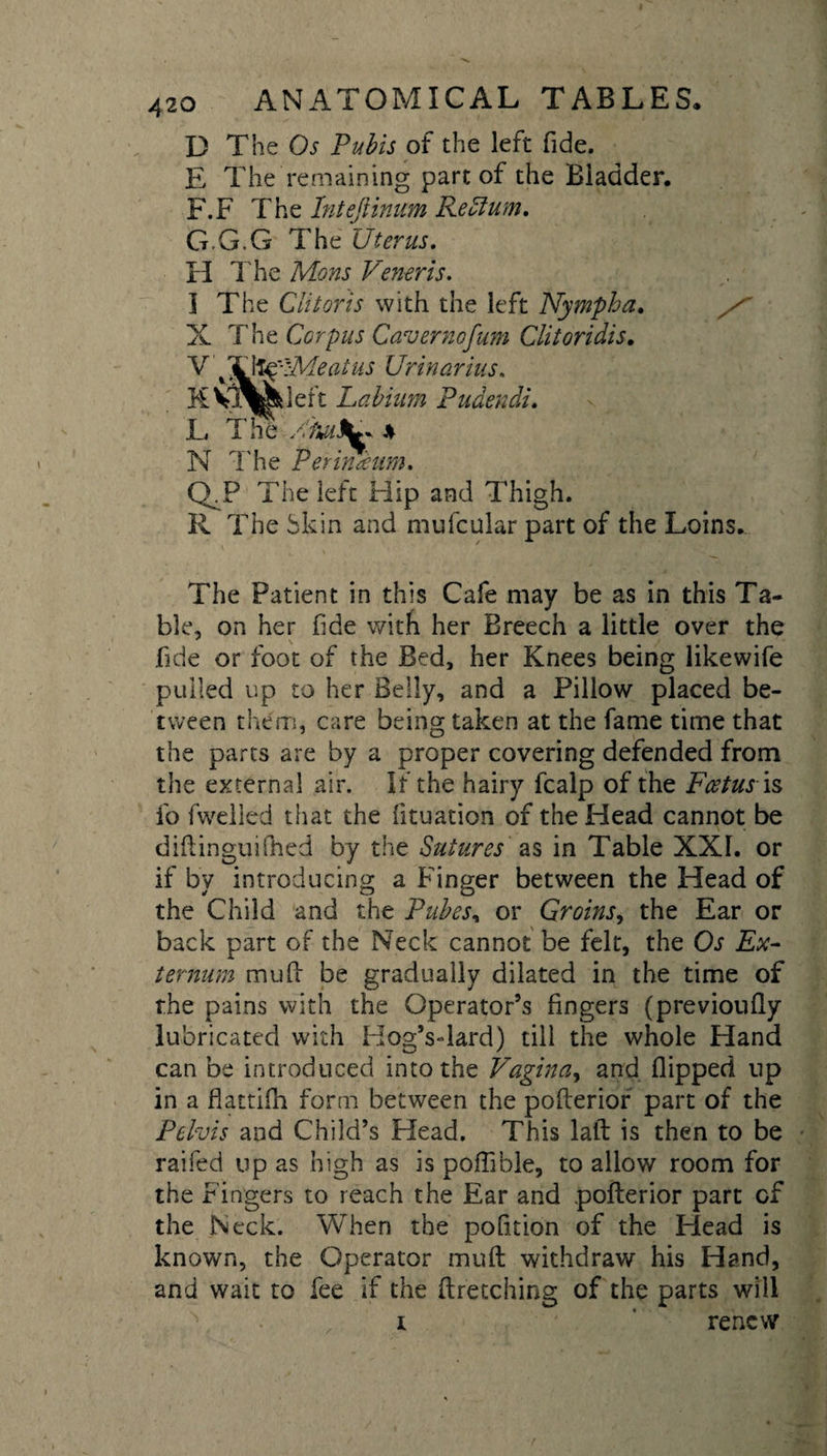 D The Os Pubis of the left fide. E The remaining part of the Bladder. F. F The Intejiinum Re Slum. G. G.G The Uterus. II The Mons Veneris. I The Clitoris with the left Nymph a. X The Corpus Cavernofum Clitoridis. SMeatus Urinarius. KVT^pdeft Labium Pudendi. L The Mmli^ % N The Perineum. Q.P The left Hip and Thigh. R The Skin and mulcular part of the Loins. The Patient in this Cafe may be as in this Ta¬ ble, on her fide with her Breech a little over the fide or foot of the Bed, her Knees being likewife pulled up to her Belly, and a Pillow placed be¬ tween them, care being taken at the fame time that the parts are by a proper covering defended from the external air. If the hairy fcalp of the Fcetus is fo (welled that the fituation of the Head cannot be difiinguiftied by the Sutures as in Table XXI. or if by introducing a Finger between the Head of the Child and the Pubes, or Groins, the Ear or back part of the Neck cannot be felt, the Os Ex¬ ternum mu(i be gradually dilated in the time of the pains with the Operator’s fingers (previoufly lubricated with Hog’sTard) till the whole Hand can be introduced into the Vagina, and flipped up in a flattifh form between the poflerior part of the Pelvis and Child’s Head. This laid is then to be railed up as high as is poflible, to allow room for the Fingers to reach the Ear and poflerior part of the Neck. When the pofition of the Head is known, the Operator mull withdraw his Hand, and wait to fee if the ftretching of the parts will i renew