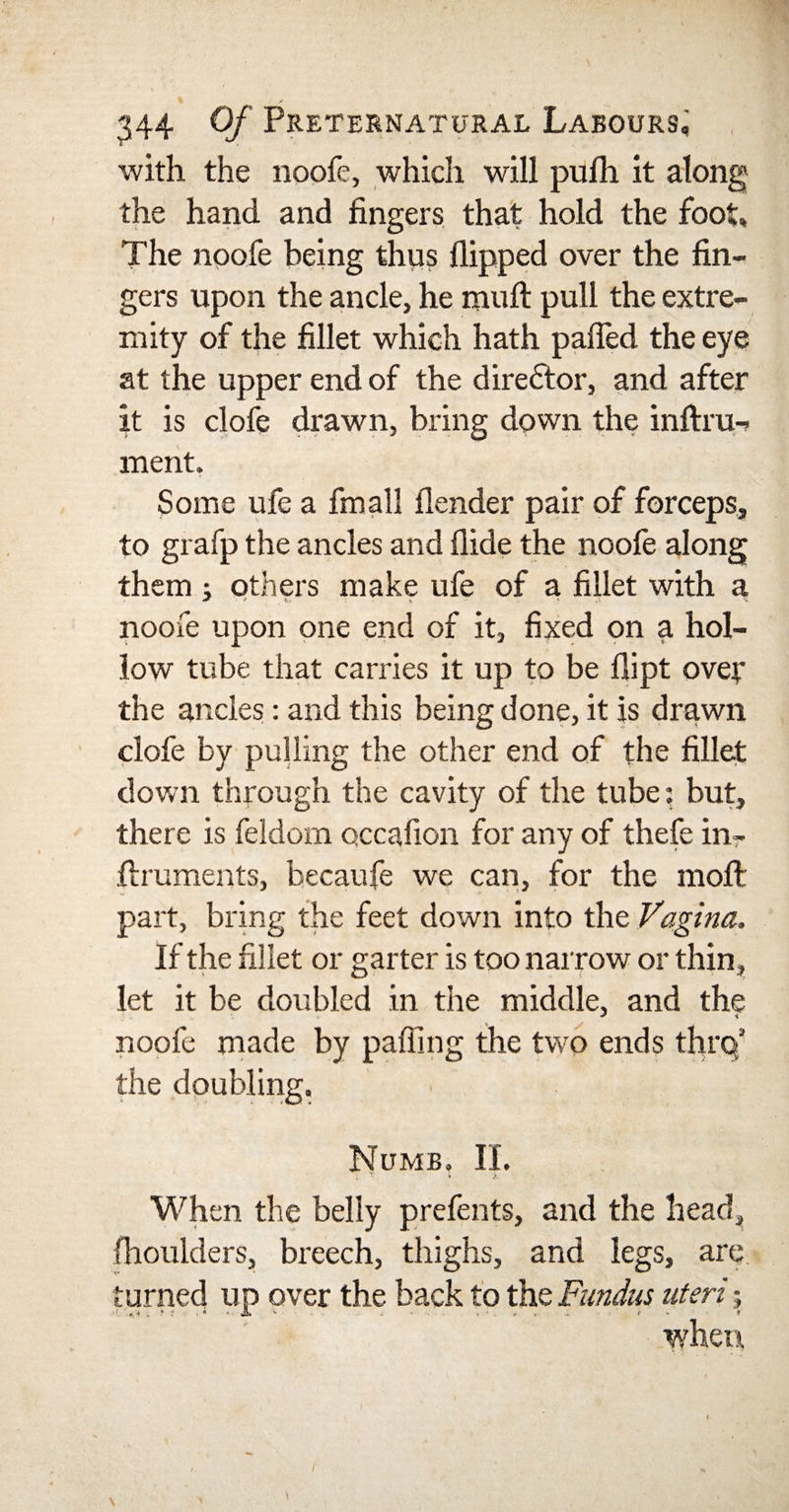 with the noofe, which will pufh it along the hand and fingers that hold the foot. The noofe being thus flipped over the fin¬ gers upon the ancle, he muft pull the extre¬ mity of the fillet which hath palled the eye at the upper end of the director, and after it is clofe drawn, bring down the inftru- ment. Some ufe a fin all flender pair of forceps, to grafp the ancles and Aide the noofe along them j others make ufe of a fillet with a noofe upon one end of it, fixed on a hol¬ low tube that carries it up to be flipt ovey the ancles: and this being done, it is drawn clofe by pulling the other end of the fillet down through the cavity of the tube: but, there is feldom occafion for any of thefe in- firuments, becaufe we can, for the moft part, bring the feet down into the Vagina. If the fillet or garter is too narrow or thin, let it be doubled in the middle, and the noofe made by paffing the two ends thro5 the doubling. Numb, II. When the belly prefents, and the head, jfhoulders, breech, thighs, and legs, are turned up over the back to the Fundus uteri; when \