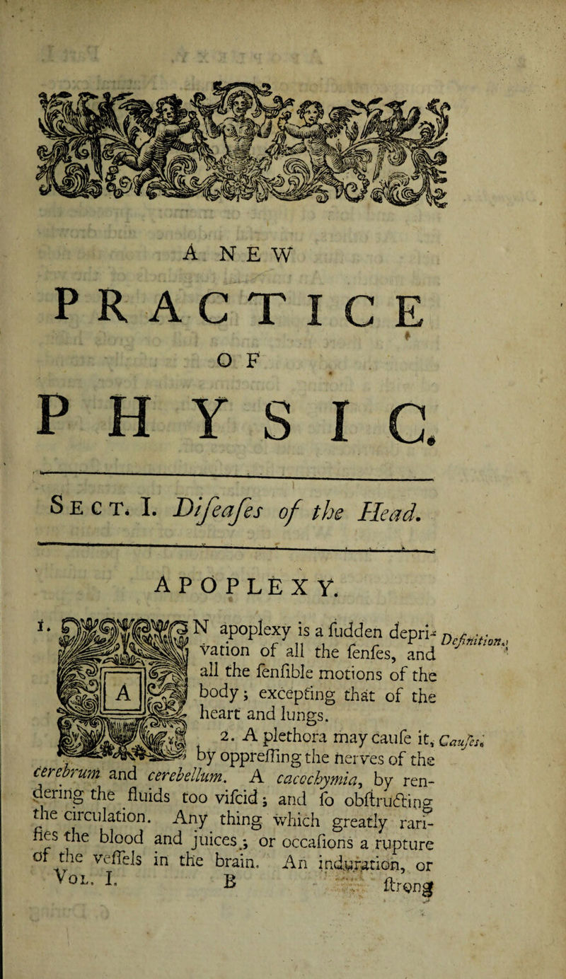 PRACTICE O F PHYSIC. >' - ... - j - Sect. I. Btfeafes of the Head. apoplexy. J N apoplexy is a fudden depri-. n vation of all the fenfes, and all the fenlible motions of the body; excepting that of the heart and lungs. 2. A plethora maycaufe it, Cau/es; by opprefTing the nerves of the A caccchymia, by ren- , enng the fluids toovifcid; and fb obftrubling the circulation. Any thing which greatly rari- nes the blood and juices *, or occafions a rupture ot the vefTels in the brain. An indufiation, or ^ ftrong