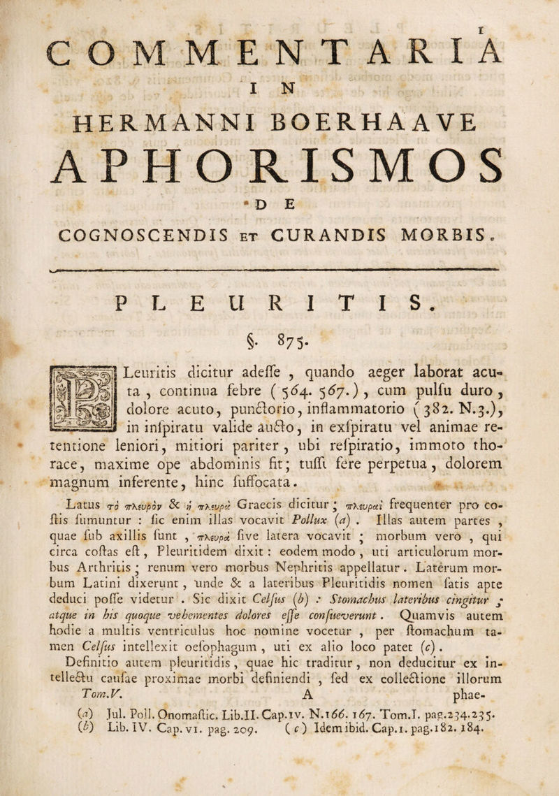 E N.T A IN HERMANNIBOERHAAVE APHORISMOS * D E COGNOSCENDIS et CURANDIS MORBIS«, PLEURITIS. §• 875- Leuritis dicitur adeffe , qnando aeger laborat acu¬ ta , continua febre ( 564. 5 67.) , cum pulfu duro 5 dolore acuto, pundlorio, inflammatorio (382. N.3.), in inlpiratu valide auido, in exfpiratu vel animae re¬ tentione leniori, mitiori pariter, ubi refpiratio, immoto tho¬ race, maxime ope abdominis fit; tuffi fere perpetua, dolorem magnum inferente, hinc fuffocata. Latus ro nxtupov & v> nrKwprj. Graecis dicitur; nrwjpai frequenter pro co- ftis fumuntur : fic enim illas vocavit Pollux (a) . Illas autem partes , quae fub axillis funt , <rr\zvp* five latera vocavit ; morbum vero , qui circa cofias eft , Fleuritidem dixit : eodem modo , uti articulorum mor¬ bus Arthritis ; renum vero morbus Nephritis appellatur . Laterum mor¬ bum Latini dixerunt , 'unde & a lateribus Pleuritidis nomen fatis apte deduci poffe videtur . Sic dixit Celfus (b) : Stomachus lateribus cingitur ; atque in his quoque vehementes dolores ejje confueverunt. Quamvis autem hodie a multis ventriculus hoc nomine vocetur , per ftomachum ta¬ men Celfus intellexit oefophagum , uti ex alio loco patet (V) . Definitio autem pleuritidis, quae hic traditur , non deducitur ex in- telle&u caufae proximae morbi definiendi , fed ex colleftione illorum Tom.V. A phae- ■00 Iui. Poli. Onomafiic. Lib.II.Cap.iv. N.idd. 167. Tom.I. pag.234.235.