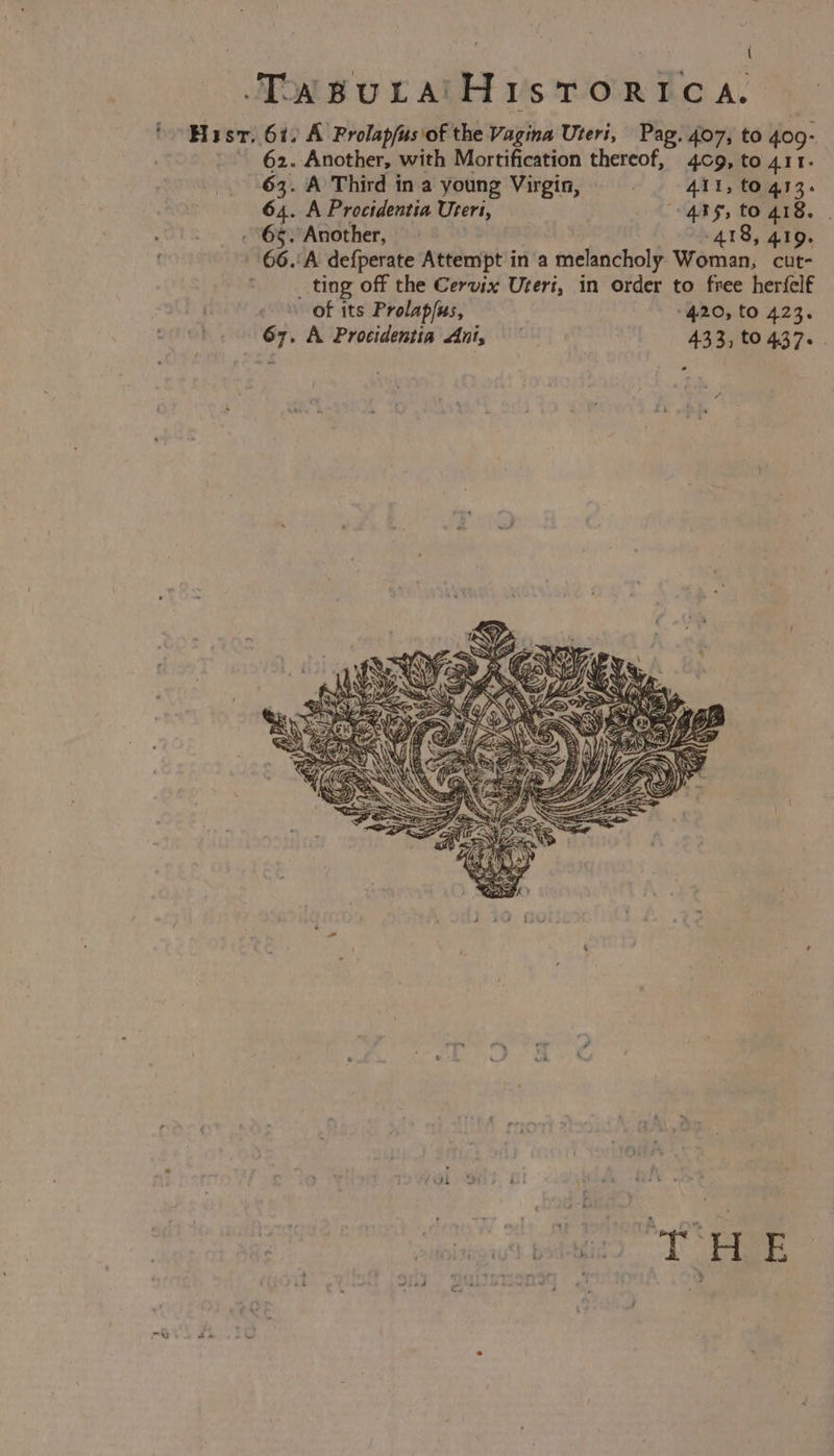 { TwruraiHirstorica. Hist. 61. A Prolap/usiof the Vagina Uteri, Pag. 407, to 409° 62. Another, with Mortification thereof, 409, to 411. 63. A Third ina young Virgin, © 411, togs3. 64. A Procidentia Uteri, 495, to 418. | - 65. Another, 418, 419.