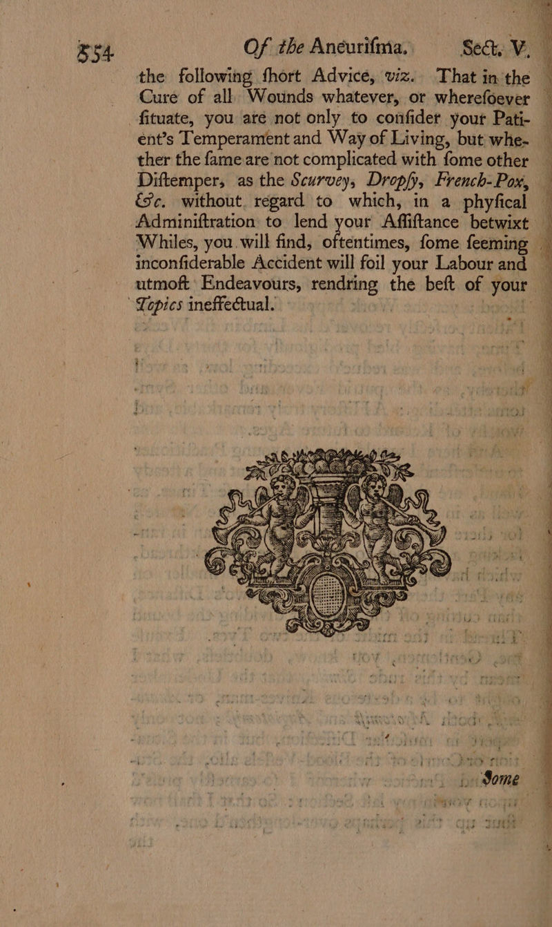 = fituate, you are not only to confider your Pati- ent’s Temperament and Way of Living, but whe- ther the fame are not complicated with fome other Diftemper, as the Scurvey, Droply, French- Pox, fc. without. regard to which, in a phyfical inconfiderable Accident will foil your Labour and * . A&amp; a) MEE rae apncls x SS eo mea {gray D Seen &gt;, \C pg a ‘@ Wie HI Bas 4} M})