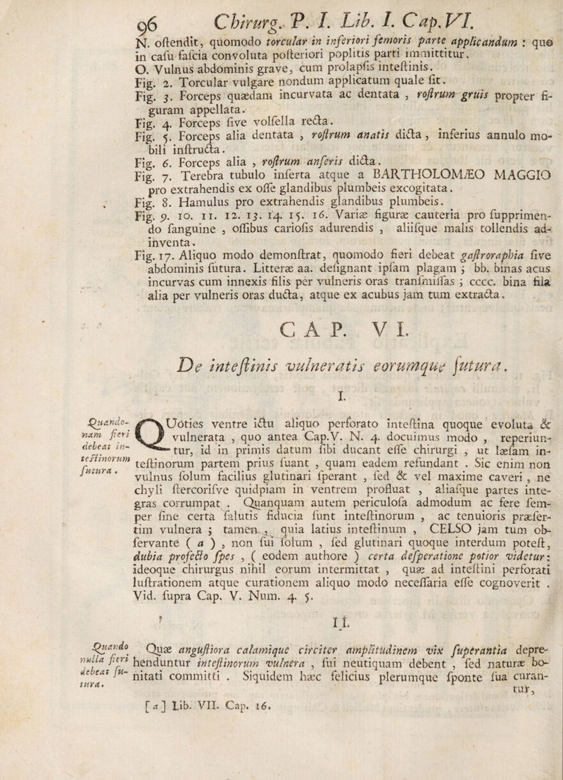 N. oftendit, quomodo torcular in inferiori femoris parte applicandum : qu® in cafu fafcia convoluta pofteriori poplitis parti immittitur. O. Vulnus abdominis grave, cum prolapfis inteftinis. Fig. 2. Torcular vulgare nondum applicatum quale fit. Fig. 3. Forceps quaedam incurvata ac dentata , roftrum gruis propter fi¬ guram appellata. Fig. 4. Forceps five volfella reda. Fig. 5. Forceps alia dentata , roftrum anatis dida, inferius annulo mo¬ bili inftruda. Fi^. 6. Forceps alia , roftrum anferis dida. Fig. 7. Terebra tubulo inferta atque a BARTHOLGMdiQ MAGGIO pro extrahendis ex ofte glandibus plumbeis excogitata. Fig. 8. Hamulus pro extrahendis glandibus plumbeis. Fig. 5?. 10. 11. 12. 13. 14. 15. 16. Variae figurae cauteria pro fupprimen- do fanguine , offibus carioiis adurendis , aliifque malis tollendis ad- inventa* Fig. 17. Aliquo modo demonftrat, quomodo fieri debeat gaftroraphia five abdominis futura. Litterae aa. deiignant ipfam plagam, bb. binas acus incurvas cum innexis filis per vulneris oras tranfmiifas ; cccc. bina fila alia per vulneris oras duda, atque ex acubus jam tum extrada, C A P. V I. De inteftinis vulneratis eorumcfue jutura. Xhtando-' Uoties ventre idu aliquo perforato inteftina quoque evoluta Sc nam psn Ii vulnerata , quo antea Cap.V. N. 4, docuimus modo , reperiun- deveat m- tUfj 'K{ jn primis datum fibi ducant eife chirurgi , ut laefam in- tcfimorum te^jnomm partem prius fuant , quam eadem refundant . Sic enim non vulnus folum facilius glutinari fperant , fed Sc vel maxime caveri , ne chyli ftercorifve quidpiam in ventrem profluat , aliafque partes inte¬ gras corrumpat . Quanquam autem periculofa admodum ac fere fem- per fine certa falutis fiducia funt inteflinorum , ac tenuioris praefer- tim vulnera $ tamen^ quia latius inteftinum , CELSO jam tum ob- fervante ( a ) , non fui fotum , fed glutinari quoque interdum poteft, dubia profeffo fpes , ( eodem authore ) certa defperatione potior videtur: Ideoque chirurgus nihil eorum intermittat , qua? ad inteftini perforati luftrationem atque curationem aliquo modo neceftaria effe cognoverit . Vid, fupra Cap. V. Num. 4. 5. * IL SpuandO' Qugg angufiora calamique circiter amplitudinem vix fuperantia depre- nulla fun henduntur inteflinorum vulnera , fui neutiquam debent , fed naturae bo- At?£at tu- nitati committi . Siquidem haec felicius plerumque fponte fua curan¬ tur . [<*] Lib. VII. Cap. 16.
