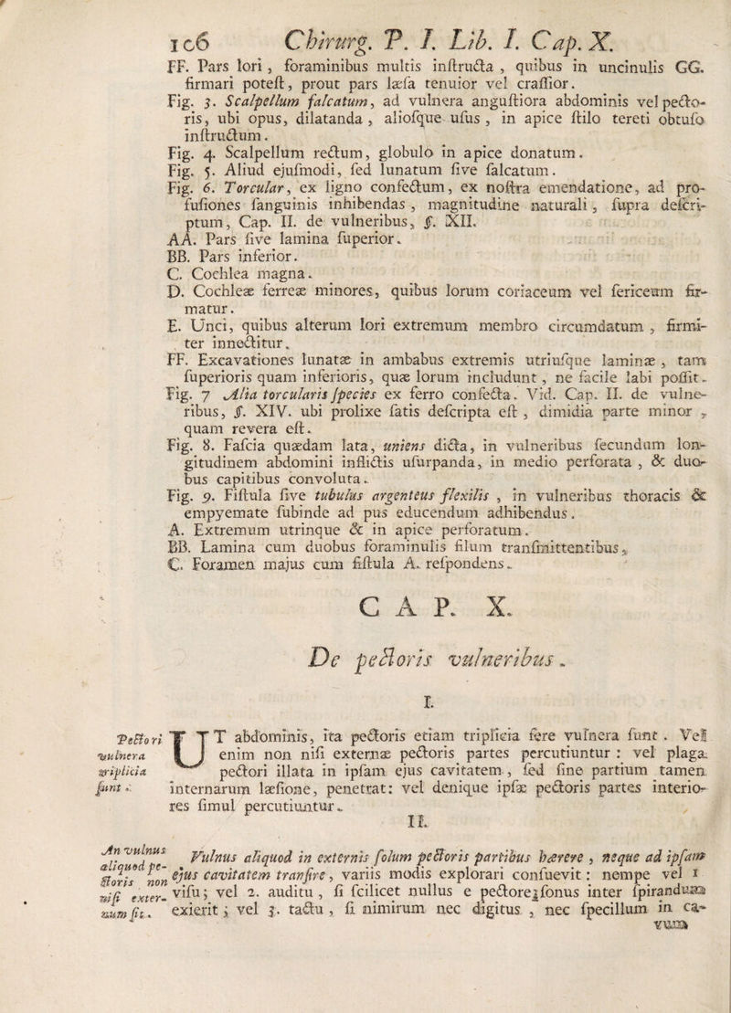 FF. Fars lori, foraminibus multis inftruda , quibus in uncinulis GG. firmari poteft, prout pars laefa tenuior vel craftior. Fig. 3- Scalpellum falcatum, ad vulnera anguftiora abdominis vel pedo¬ ris, ubi opus, dilatanda, aliofque ufus , in apice ftilo tereti obtufo inftrudum. Fig. 4 Scalpellum redum, globule in apice donatum. Fig. 5. Aliud ejufmodi, fed lunatum five falcatum. Fig. 6. Torcular, ex ligno confedum, ex noftra emendatione, ad pro- fufiones fanguinis inhibendas , magnitudine naturali, fupra defcri- ptum, Gap. II. de vulneribus, §. XIL A A. Pars five lamina fuperior. BB. Pars inferior. C. Cochlea magna.. D. Cochleae ferreae minores, quibus Iorum coriaceum vel fericemn fir¬ matur . E. Unci, quibus alterum lori extremum membro circumdatum , firmi¬ ter inneditur. FF. Excavationes lunatae in ambabus extremis utriufque laminae , tam fuperioris quam inferioris, quae lorum includunt, ne facile labi poffit.. Fig. 7 Allia torcularii jpecies ex ferro confeda. Vrd. Cap. II. de vulne¬ ribus, Jf. XIV. ubi prolixe fatis defcripta eft , dimidia parte minor , quam revera eft. Fig. 8. Fafcia quaedam lata, uniens dida, in vulneribus fecundam lon¬ gitudinem abdomini inflidis ufurpanda, in medio perforata , &amp; duo¬ bus capitibus convoluta. Fig. p. Fiftula five tubulus argenteus flexilis , in vulneribus thoracis &amp; empyemate fubinde ad pus educendum adhibendus. A. Extremum utrinque 8c in apice perforatum . BB. Lamina cum duobus foraminulis filum tranfmittentibus * C Foramen majus cum fiftula A... refpondens„ ■ GAP. X. De peblorh vulneribus. r. Teltorl T TT abdominis, ita pedoris etiam triplicia fere vulnera funt . Vel iwlnera I! enim non nifi externae pedoris partes percutiuntur vel plaga triplici* pedori illata in ipfam ejus cavitatem , fed fine partium tamen. internarum laefione, penetrat: vel denique ipfae pedoris partes interio^ res fimui percutiuntur „ &gt; h-fc. /  II, An vulnus yujnus aUquod in externis folum pe Horis partibus btfrere , neque ad ipfarrp ‘Bolis ‘ mn eJus cclrv'ltatem tranjire, variis modis explorari confuevit: nempe vel x mi[I*Sexter- v^u &gt; ve^ 2- auditu , fi fcilicet nullus e pedore|fonus inter fpiranduna numfit. exierit ; vel 3, tadu , fi nimirum nec digitus , nec fpecillum in