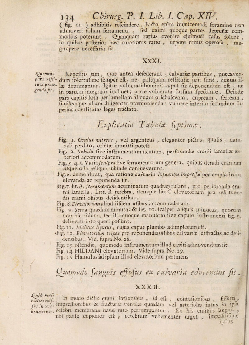 ( fig. ii. ) adhibitis refcindere» Fa&amp;o enim hujufcemodi foramine non admoveri folum ferramenta , fed eximi quoque partes depreftas com¬ modius poterunt . Quanquam rarius evenire ejufmodi cafus foient , in quibus pofterior haec curationis ratio , utpote nimis operofa , ma¬ gnopere neceffaria iit. XXXI. .Quomodo Repolitis jam , quae antea defederant , calvariae partibus , praecavero Pars dum folertiflime femper eft, ne, poftquam reftitutae jam funt, denuo il~ tutaprote« deprimantur. Igitur vulnerati hominis caput fic deponendum eft , ut gsndafit. in partem integram inclinet; parte vulnerata furfum ipeftante . Deinde pars capitis laefa per lamellam aliquam ori chalceam , cupream , ferream , limilemque aliam diligenter praemunienda: vulnere interim fecundum fu- perius conftitutas leges tradato. * Explicatio Tabula fept/ma. fig. i. Oculus vitreus , vel argenteus * eleganter pi&amp;us, qualis , natu¬ rali perdito, orbitae immitti poteft. Fig. 2. Subula live inftrumentum acutum, perforandae cranii lamellae ex¬ teriori accommodatum. Fig. 4- 5. Varia fcalpra five ferramentorum genera, quibas deradi cranium atque Olfa reliqua fubinde confue verant. Fig.6. demonftrat, qua ratione calvaria infantum imprejja per emplaftrum elevanda ac reponenda fit. Fig.7. Iit. A. ferramentum acuminatum quadrangulare, pro perforanda cra¬ nii lamella. Litt. B. terebra, itemque litt.C.elevatorium pro reftituen- dis cranii oftibus defidentibus. Fig. Elevatorium aliud iifdem ufibus accommodatum. Fig. 9. Serra quaedam minuta; &amp; fig. 10. fcalper aliquis minutus, quorum non hic folum, fed ifta quoque manubrio five capulo inftrumenti fig. 3, delineati intorqueri poftunt. Fig. n. Malleus ligneus, cujus caput plumbo adimpletum eft. *Fig, 12. Elevatorium tripes pro reponendis oftibus calvarias diifraftis ac defi¬ dentibus . Vid. fupra No. 28. Fig. 1 j. offendit, quomodo inftrumentum illud capiti admovendum fit. Fig. 14, HfLDANI elevatorium. Vide fupra No. 29. Fig. 15. Hamulus ad ipfum illud elevatorium pertinens. Quomodo J'anguis ejfujus XXXII. fxdtet mif 1T1°d° cranii laefionibus , id eft 5 contufionibus fiiiuns jus in cni* iniprellionibus &amp; fra&amp;uris venulas- quaedam vel arteriolae intus m ipfa brumeruor. celebri membrana haud raro perrumpuntur . Ex his emiftus {anguis , ubi paulo copioiior eft r cerebrum vehementer urget , impearnfq ue n