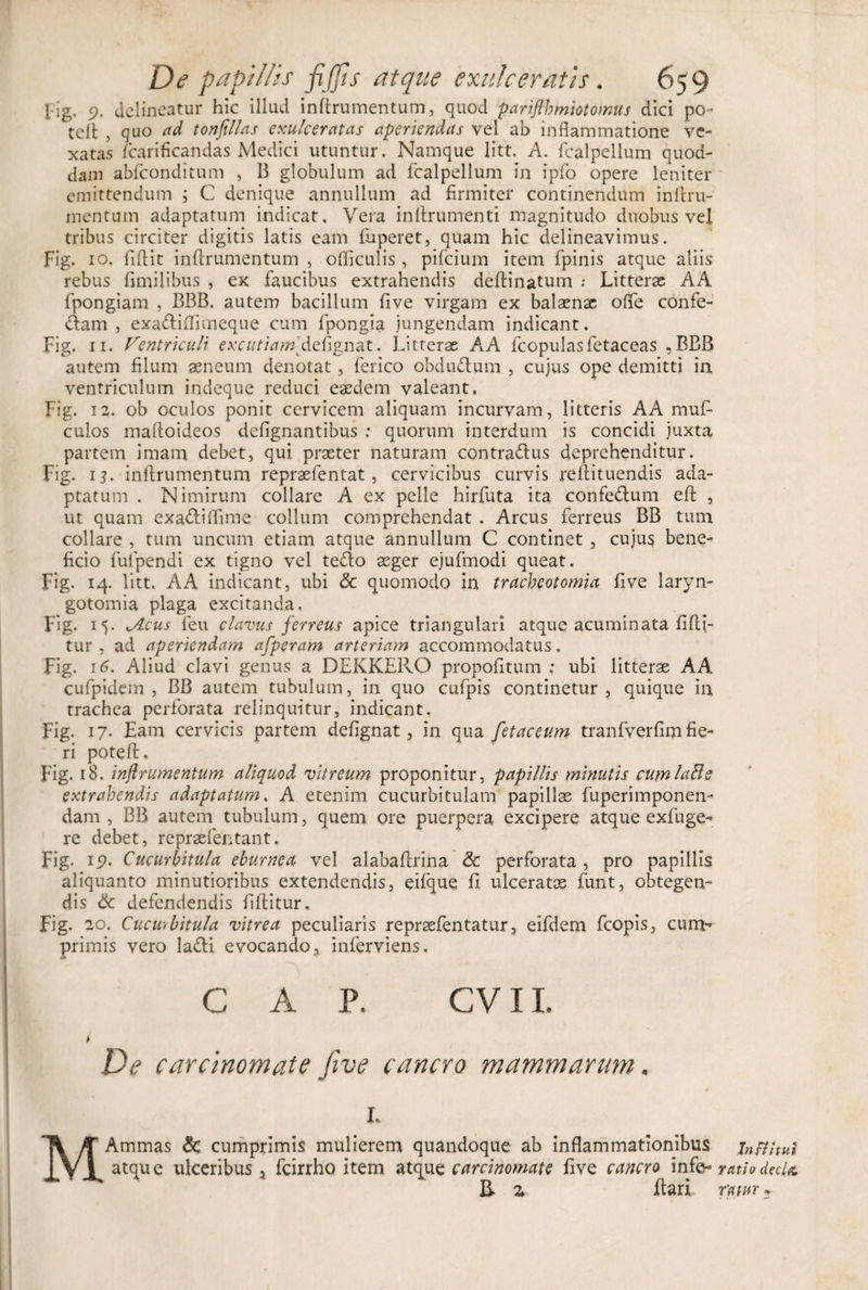 fig. 5&gt;. delineatur hic illud inftrumentum, quod pariftbmiotoinus dici po- teit , quo ad tonftllas exulceratas aperiendas vel ab inflammatione ve¬ xatas fcarificandas Medici utuntur. Namque litt. A. fcalpellum quod- dam abfeonditum , B globulum ad fcalpellum in ipfo opere leniter emittendum ; C denique annullum ad firmiter continendum initru- mentum adaptatum indicat. Vera inftrumenti magnitudo duobus vel tribus circiter digitis latis eam fuperet, quam hic delineavimus. Fig. 10. fiflit inftrumentum , ofticulis, pifeium item fpinis atque aliis rebus fimilibus , ex faucibus extrahendis deftinatum ; Litterae AA fpongiam , BBB. autem bacillum five virgam ex balaenx ofife confe- dam , exadiftimeque cum fpongia jungendam indicant. Fig. 11. Ventriculi excutiam fignat. Litterx AA fcopulasfetaceas ,BBB autem filum aeneum denotat, ferico obdu&amp;um , cujus ope demitti in ventriculum indeque reduci eaedem valeant. Fig. 12. ob oculos ponit cervicem aliquam incurvam, litteris AA muf- culos maftoideos defignantibus ; quorum interdum is concidi juxta partem imam debet, qui praeter naturam contra&amp;us deprehenditur. Fig. ij. inftrumentum repraefentat , cervicibus curvis reftituendis ada¬ ptatum . Nimirum collare A ex pelle hirfuta ita confe&amp;um eft , ut quam exa&amp;iflime collum comprehendat . Arcus ferreus BB tum collare , tum uncum etiam atque annullum C continet , cujus bene¬ ficio fufpendi ex tigno vel te£lo aeger ejufmodi queat. Fig. 14. litt. A A indicant, ubi &amp; quomodo in tracheotomia five laryn¬ gotomia plaga excitanda. Fig. 15. yAcus feu clavus ferreus apice triangulari atque acuminata fifti- tur , ad aperiendam afperam arteriam accommodatus. Fig. 16. Aliud clavi genus a DEKKERO propofitum .* ubi litterae AA cufpidem , BB autem tubulum, in quo cufpis continetur, quique in trachea perforata relinquitur, indicant, Fig. 17. Eam cervicis partem defignat, in qua fetaceum tranfverfim fie¬ ri poteft, Fig. 18. inftrumentum aliquod vitreum proponitur, papillis minutis cumlafte extrahendis adaptatum. A etenim cucurbitulam papillae fuperimponen- dam , BB autem tubulum, quem ore puerpera excipere atque exfuge- re debet, repraefentant. Fig. 1 p. Cucurbitula eburnea vel alabaftrina &amp; perforata , pro papillis aliquanto minutioribus extendendis, eifque fi ulceratae funt, obtegen¬ dis &amp; defendendis fiftitur, Fig. 20. Cucurbitula vitrea peculiaris repraefentatur, eifdem fcopis, cum¬ primis vero la&amp;i evocando, inferviens. C A P. CV11. De carcinomate five cancro mammarum. M L Ammas &amp; cumprimis mulierem quandoque ab inflammationibus atque ulceribus , fcirrho item atque carcinomate five cancro infes- &amp; z ftari In ft i tui ratio decltt ratur ?