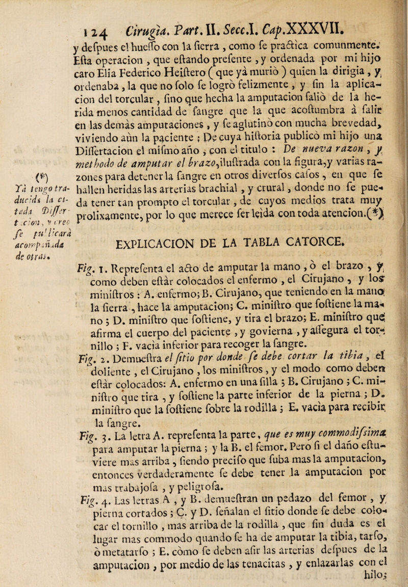 y de iones eíhueflfo con la fierra , como fe praftica comunmente; Efta operación , que eftando prefenre , y ordenada por mi hijo caro Elia Federico Heiftero ( que ya murió ) quien la dirigía, y, ordenaba, la que no folo fe logró felizmente, y fin la aplica¬ ción del torcular , fino que hecha la amputación falió de la he¬ rida menos cantidad de fangre que la que acoftumbra a falir en las demás amputaciones, y fe aglutinó con mucha brevedad, viviendo aun la paciente ; Pe cuya hitioria publicó mi hijo una Disertación el mifmoaño , con el titulo : De nueva razón , y \ methodo de amputar el brazo.)iluílrada con la figura,y varias ra- ■(*) zones para detener la fangre en otros diverfoscafos, en que fe Ya tengo tra- hallen heridas las arterias brac'nial, y crural, donde no fe pue- durdi la ct■ ja £ener tan prompto el torcular , de cuyos medios trata muy T f t r 7vf;’í prolixamente, por lo que merece fer leída con toda atención.^) fe tif lie ara ’aconp.ñJa EXPLICACION DE LA TABLA CATORCE. deotrrii* Fig. 1. Reprefenta el ado de amputar la mano , o el brazo , || como deben eftár colocados el enfermo , el Cirujano , y los1 miniftros : A. enfermo; B. Cirujano, que teniendo en la mana: la fierra , hace la amputación; C. miniftro que foftiene la ma&lt; no ; D. miniftro que foftiene, y tira el brazo; E. miniftro queí afirma el cuerpo del paciente , y govierna , y allegara el tor¬ nillo ; F. vacia inferior para recoger la fangre. Fig. 2.Demueftra el fitlu por donde fe debe cortar la tibia , eí doliente , el Cirujano , los miniftros , y el modo como deben eftár colocados: A. enfermo en una filia , B. Cirujano ; C. mi¬ niftro que tira , y foftiene la parte inferior de la pierna ; O» miniftro que la foftiene fobre la rodilla; E» vacia para recibir, la fangre. ^ Fig. 3. La letra A. reprefenta la parte, que es muy commodijsima para amputar la pierna ; y la B. el femor. Pero íi el daño eftu- viere mas arriba , tiendo precifoque fuba masía amputación, entonces verdaderamente fe debe tener la amputación por mas ttabajofa , y peligrofa. Fig. 4. Las letras ^ , y B. demueftran un pedazo del femor , y apierna cortados ; C. y D. feñalan el fitio donde fe debe colo¬ car el tornillo , mas arriba de la rodilla , que fin duda es ei lugar mas commodo quando fe ha de amputar la tibia, tarfoj bmetatarfo ; E. como fe deben afir las arterias defpues de la amputación , por medio de las tenacitas, y enlazarlas con el (
