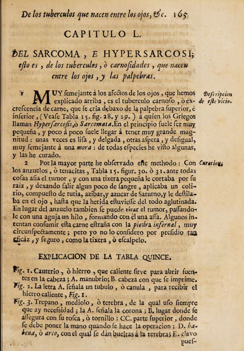 I —. r _ i. „ I r - * ■ r • y - ■ .* . ' •' y CAPITULO L. t&gt;EL SARCOMA , E HYPER SARCO Si} ejlo es , de los tubérculos, o carnosidades , que nacen entre los ojos , y las palpebras, T A Jí UY femejante á los afeaos de los ojos , que hemos (Deferipcion JfVl explicado arriba , es el tuberculo carnoío , bex- de efte^icto. crefcencia de carne, que fe cria dcbaxo de 4 palpebra fuperior, é inferior , ( Veafe Tabla 15. fig. 28. y 29. ) á quien los Griegos llaman HyperfarcoJis%b Sarcomata.En el principio fuele fer muy pequeña, y poco á poco fuele llegar á tener muy grande mag¬ nitud : unas veces es lifa , y delgada , otras afpera, y defigual, muy femejante á una mora : de todas efpecieshe vifto algunas, y las he curado. , ( 2 Por la mayor parte he obfervado efte rnethodo : Con Cumiot* los anzuelos, 6 tenacitas, Tabla 15. figur. 30. ó 31. ante todas cofas alia el tumor , y con una tixerapequeña le cortaba por fu raíz , y dexando falir algún poco de fangre , aplicaba un coli¬ rio, compuerta de tutia, azibar,y azúcar de Saturno,y le deftila- ba en el ojo , harta que la herida cftuvieiíe del todo aglutinada. En lugar del anzuelo también fe puede tirar el tumor, paflando- le con una aguja un hilo , formando con él una alfa. Algunos in* rentan confumir efta carne eftraña con la piedra, infernal, muy circunfpe&amp;amente; pero yo no lo coníidero por preíidio $.&lt;&amp; fificáz, y feguro, como la tixera , ó efcalpelo. EXPLICACION DE LA TABLA QUINCE. t. Cauterio , ó hierro , que caliente firve para abrir fueiv* tes en la cabeza 5 A. manubrio, B, cabeza con que fe imprime. F/£. 2. La letra A, feñala un tubulo, ócanula , para recibir el hierro caliente, Fig. I. 3&gt; Trepano , medido, o terebra, de la qual ufo íiempre que ay necefsidad i la A. feñala la corona ; B. lugar donde fe aífegura con fu rofca , o tornillo : CC. parte fuperior , donde fe debe poner la mano quando fe hace la operación ; D. ha* ¡&gt;ena¡ ó arco, con el qual fe dánbueltasá ha terebras E. clavo • ’ Puef-