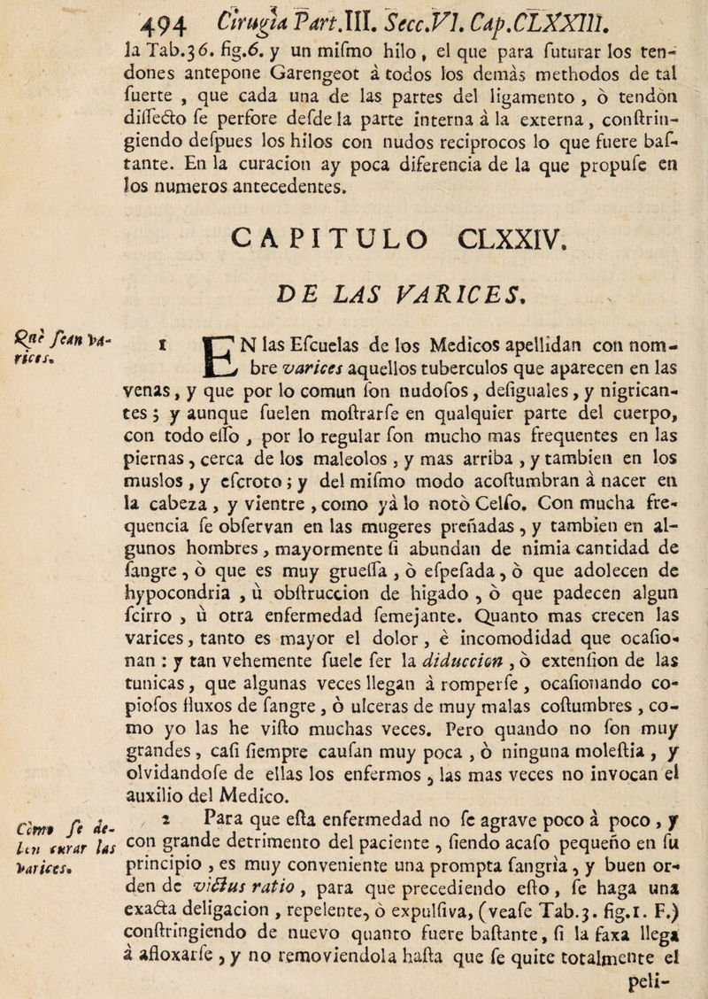 Rnc fe an 1?4- rietsn Cem* f ■ ¿V- Itn turar las Varices* 494 Cirugía Part.Wl. Secc.VL Cap.CLXXm. la Tab.36. fig.6. y un mifmo hilo , el que para futurar los ten¬ dones antepone Garengeot á todos los demás methodos de tal fuerte , que cada una de las partes del ligamento , 6 tendón diíledto fe perfore defdela parte interna á la externa, conftrin- giendo defpues los hilos con nudos reciprocos lo que fuere baf- tante. En la curación ay poca diferencia de la que propufe en Jos numeros antecedentes. CAPITULO CLXXIV. DE LAS VARICES, i C7 N las Efcuelas de los Medicos apellidan con notn- p1v bre varices aquellos tubérculos que aparecen en las venas, y que por lo común fon nudofos, deíiguales, y nigrican¬ tes j y aunque fuelen moftrarfe en qualquier parte del cuerpo, con todo elfo , por lo regular fon mucho mas frequentes en las piernas, cerca de los maléolos , y mas arriba , y también en los muslos , y eferoto; y del mifmo modo acoftumbran á nacer en la cabeza , y vientre , como ya lo notó Celio. Con mucha fre- quencia fe obfervan en las mugeres preñadas , y también en al¬ gunos hombres , mayormente fi abundan de nimia cantidad de fangre , ó que es muy grueífa , ó efpefada, ó que adolecen de hypocondria , ü obftrucdon de hígado , ó que padecen algún feirro &gt; ü otra enfermedad femejante. Quanto mas crecen las varices, tanto es mayor el dolor, é incomodidad que ocafio- nan : y tan vehemente fuele fer la diduccicn , ó exteníion de las tunicas, que algunas veces llegan á romperfe , ocaíionando co- piofos lluxos de fangre , ó ulceras de muy malas coftumbres , co¬ mo yo las he vifto muchas veces. Pero quando no ion muy grandes , caíi fiempre caufan muy poca , ó ninguna moleftia , y olvidandofe de ellas los enfermos , las mas veces no invocan el auxilio del Medico. z 2 Para que efta enfermedad no fe agrave poco á poco , y con grande detrimento del paciente , fiendo acafo pequeño en fu principio , es muy conveniente una prompta fangria, y buen or¬ den de v'ióius ratio , para que precediendo efto, fe haga una exa&amp;a deligacion , repelente, ó expulfiva, (veafe Tab.3. fig.i. F.) conftringiendo de nuevo quanto fuere bañante, íi la faxa llega á afloxarfe , y no removiéndola hafta que fe quite totalmente el peli-