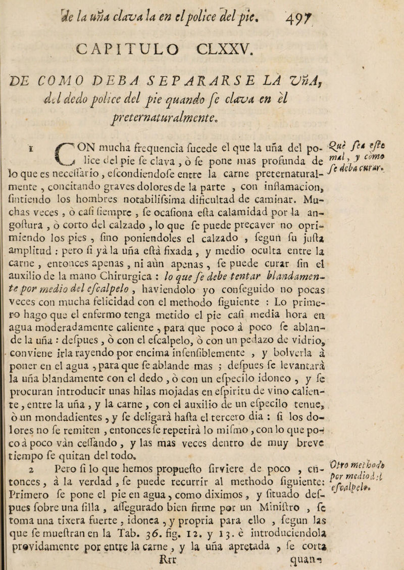 CAPÍTULO CLXXV. % DE COMO DEBA SEPARARSE LA VñA, dd dedo pólice del pie quando fe clava en el preternaturalmente; 1 ON mucha frequencia fucede el que la uña del po- fed *fl6 \_j lice del pie fe clava , ó fe pone mas profunda de wm lo que es neceífario, efcondiendofe entre la carne preternatural- ^ € a mente •&gt; concitando graves dolores de la parte •, con inflamación* ñutiendo los hombres notabiljfsima dificultad de caminar. Mu¬ chas veces 5 ó cali ñeaipre , fe ocafiona efta calamidad por la an- goftura , ó corto del calzado , lo que fe puede precaver no opri¬ miendo los pies , fino poniéndoles el calzado , fegun fu juila amplitud : pero fi ya la uña eftá fixada , y medio oculta entre la carne , entonces apenas , ni aun apenas , fe puede curar fin ei auxilio de la mano Chirurgica : ¡o que fe debe tentar blandamen- te por medio del efcalpelo , haviendolo yo confeguido no pocas veces con mucha felicidad con el methodo figuiente : Lo prime¬ ro hago que el enfermo tenga metido el pie cafi media hora en agua moderadamente caliente , para que poco á poco fe ablan¬ de la uña * defpues * 6 con el efcalpelo, ó con un pedazo de vidrio* conviene irla rayendo por encima infenfiblemente , y bolvcrla á poner en el agua , para que fe ablande mas j defpues fe levantará la uña blandamente con el dedo , ó con un efpecilo idoneo , y fe procuran introducir unas hilas mojadas enefpiritu de vino calien¬ te , entre la uña , y la carne , con el auxilio de un efpecilo tenue* o un mondadientes , y fe deligará hafta el tercero dia : fi los do¬ lores no fe remiten , entonces fe repetirá lo mifmo , con lo que po-? coa poco ván ceífando * y las mas veces dentro de muy breve tiempo fe quitan del todo* 2 Pero fi lo que hemos propuefto firviere de poco , en¬ tonces * á la verdad , fe puede recurrir al methodo figuiente: Primero fe pone el pie en agua &gt; como diximos , y fituado def¬ pues fobre una filia , aífegurado bien firme por un Miniftro , fe toma una tixera fuerte , idonea , y propria para ello , fegun las que fe mueftran en la Tab. 36. fig. 12. y 13. é introduciéndola próvidamente por entre la carne , y la uña apretada ? fe corta Rtr quan« Otro rnelho'tb per medio dd eítAlpel» o